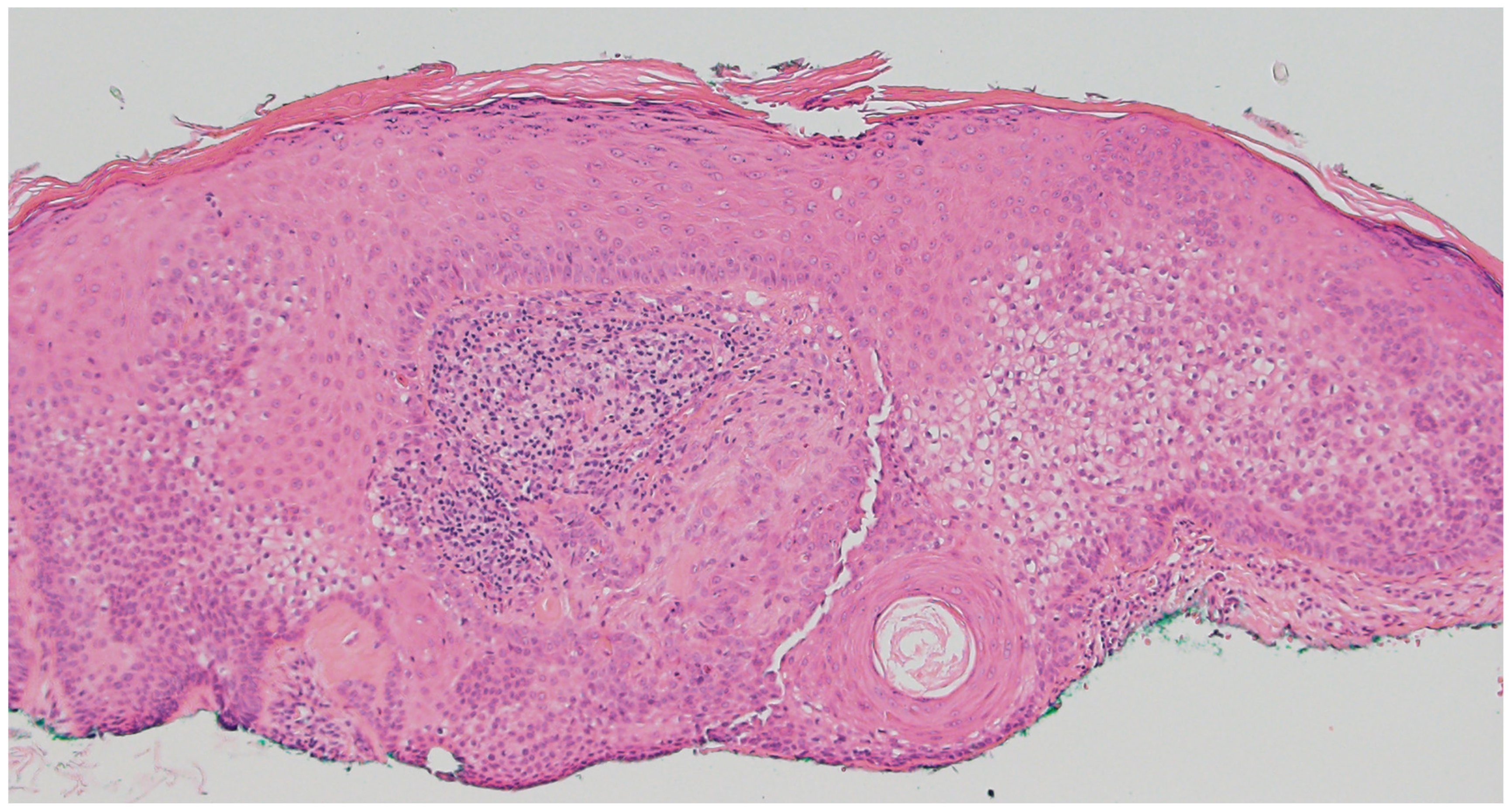 Dermatopathology 12 00034 g002 Dermatopathology 12 00034 g002
