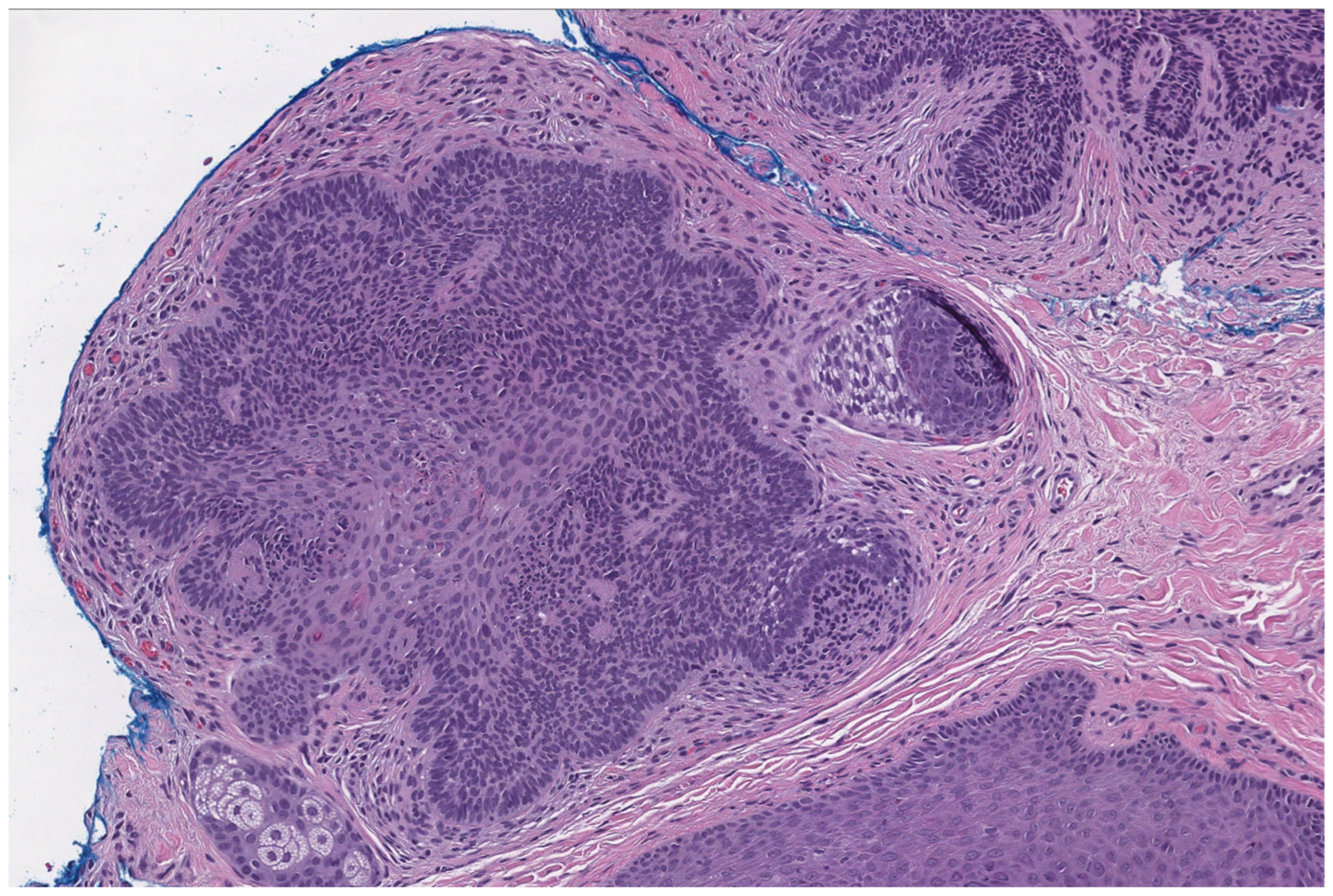 Dermatopathology 12 00034 g004 Dermatopathology 12 00034 g004