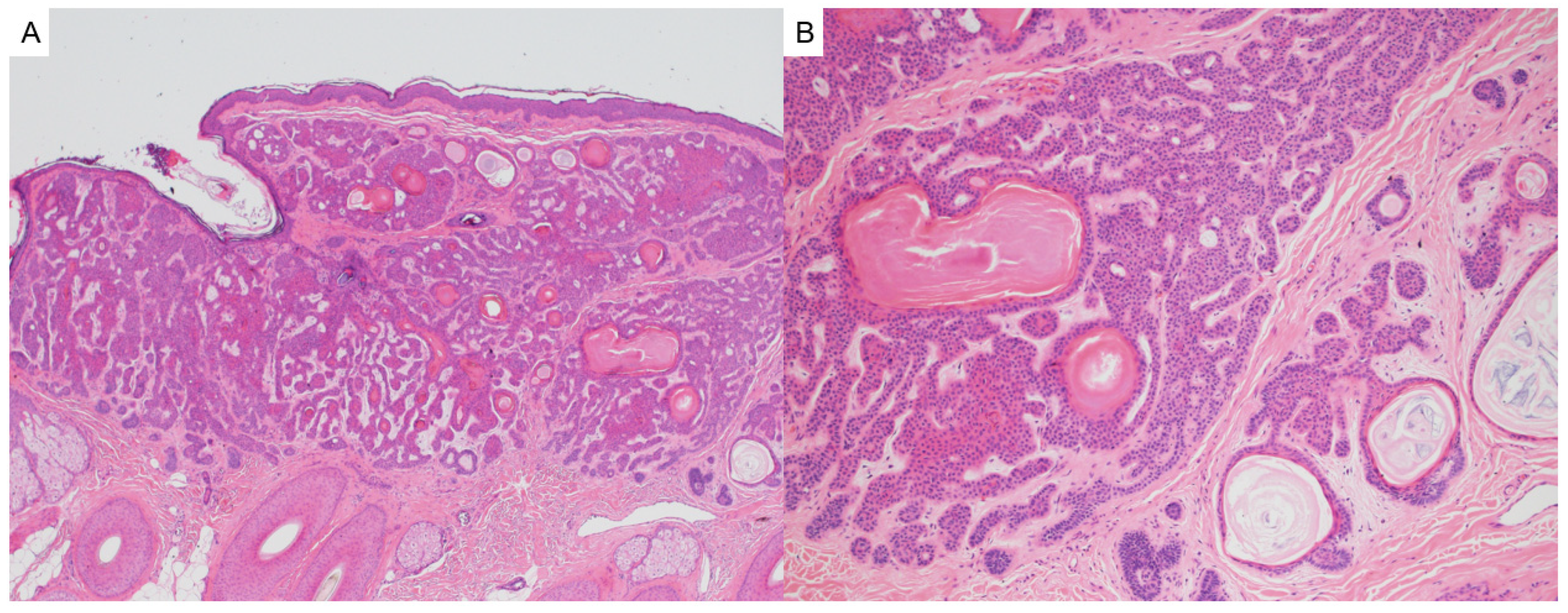 Dermatopathology 12 00034 g005 Dermatopathology 12 00034 g005