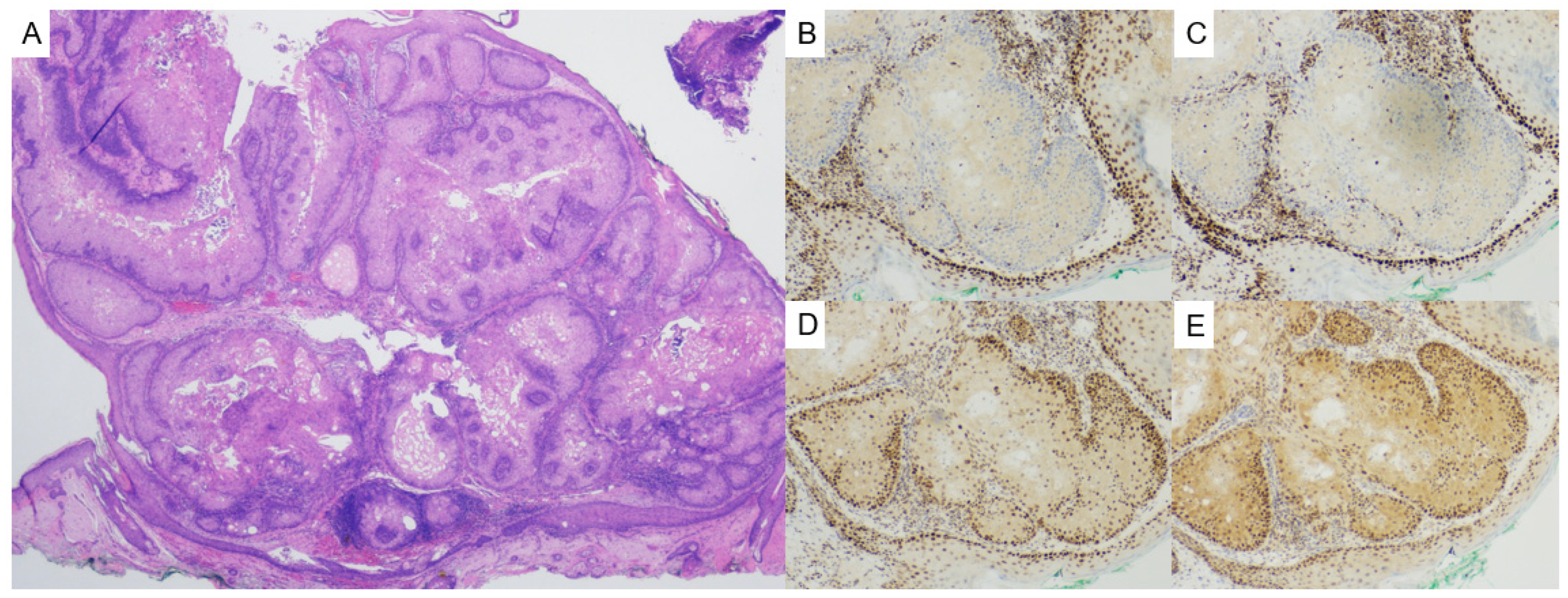 Dermatopathology 12 00034 g006 Dermatopathology 12 00034 g006