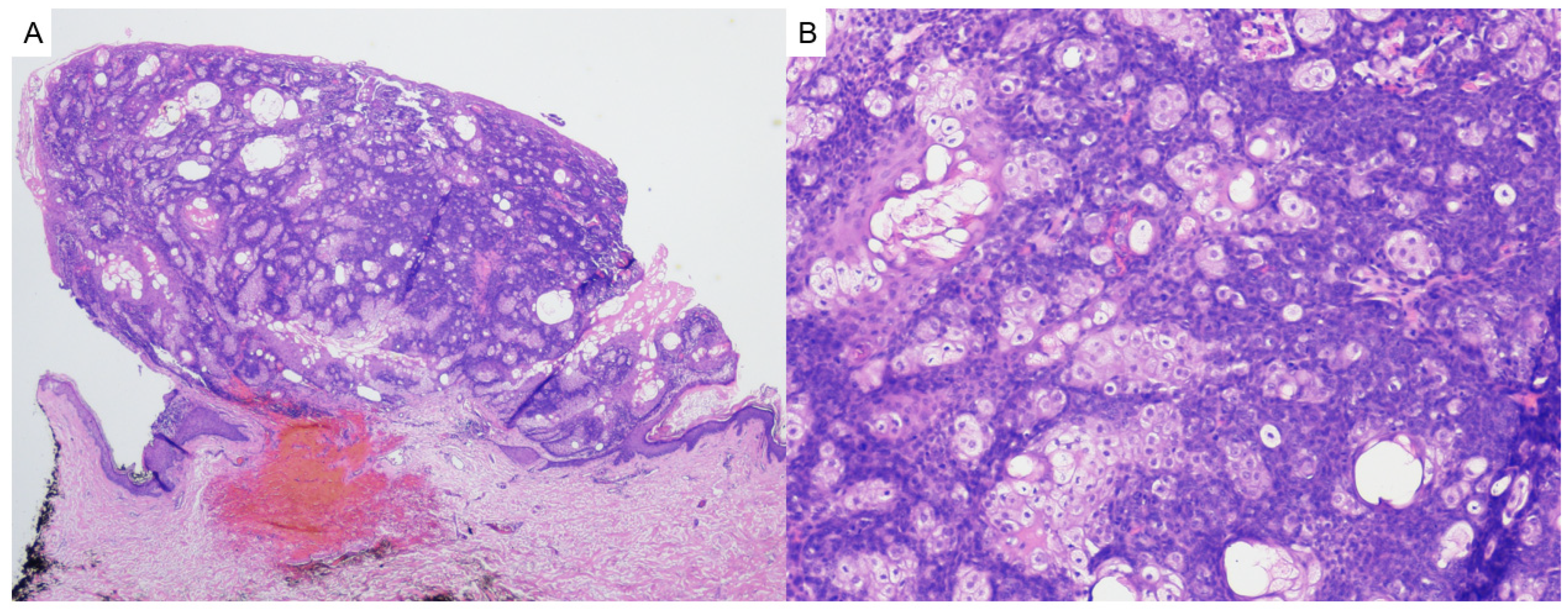 Dermatopathology 12 00034 g007 Dermatopathology 12 00034 g007