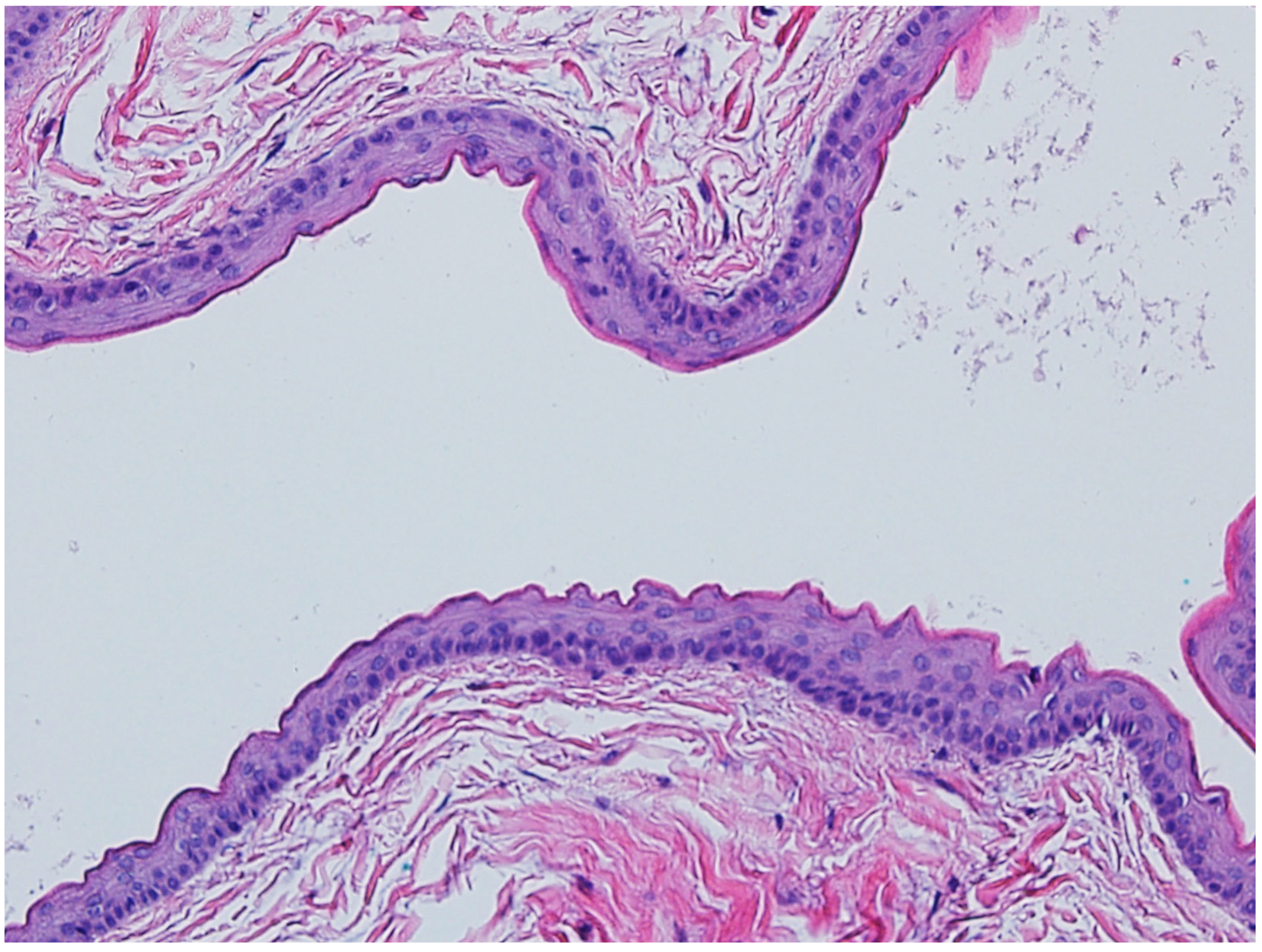 Dermatopathology 12 00034 g008 Dermatopathology 12 00034 g008