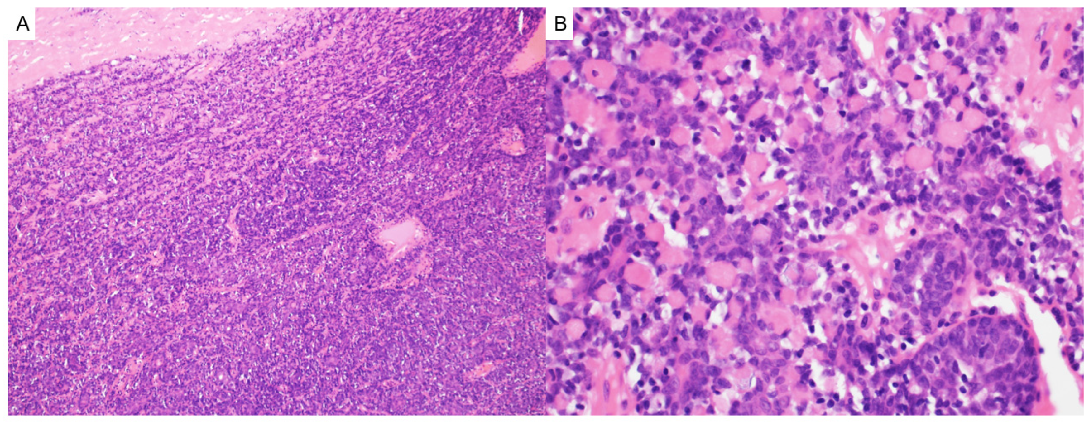 Dermatopathology 12 00034 g010 Dermatopathology 12 00034 g010