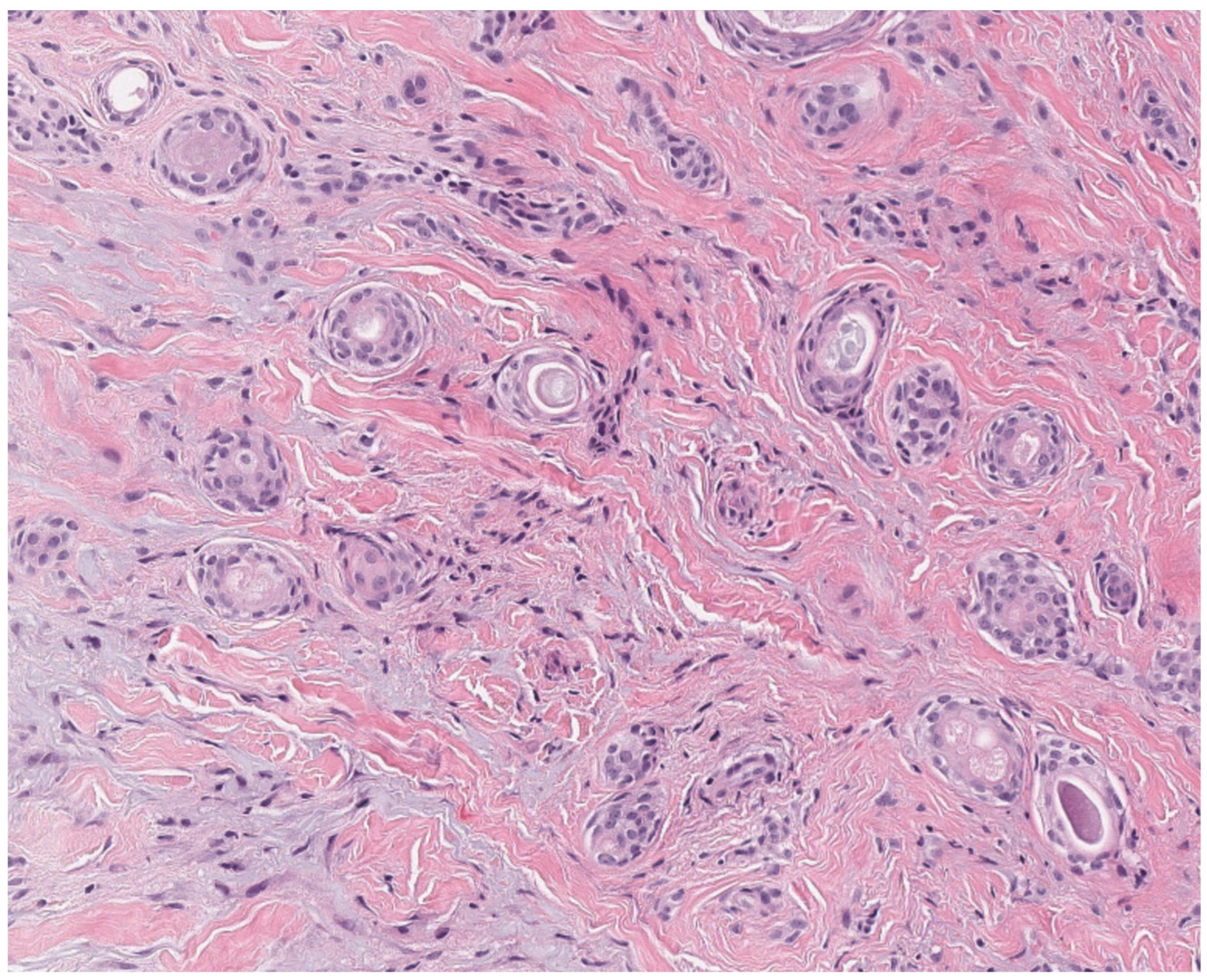 Dermatopathology 12 00034 g011 Dermatopathology 12 00034 g011