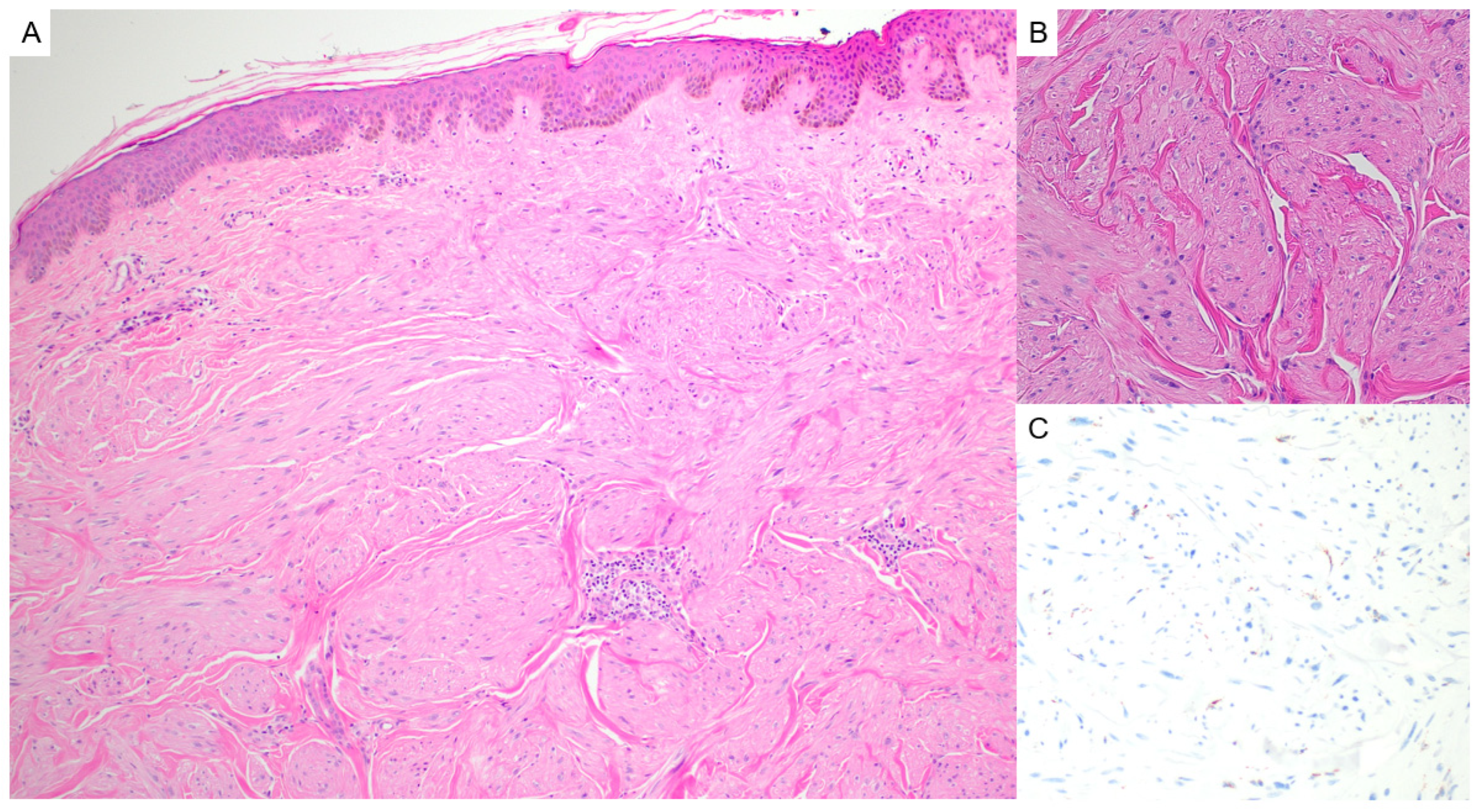 Dermatopathology 12 00034 g013 Dermatopathology 12 00034 g013