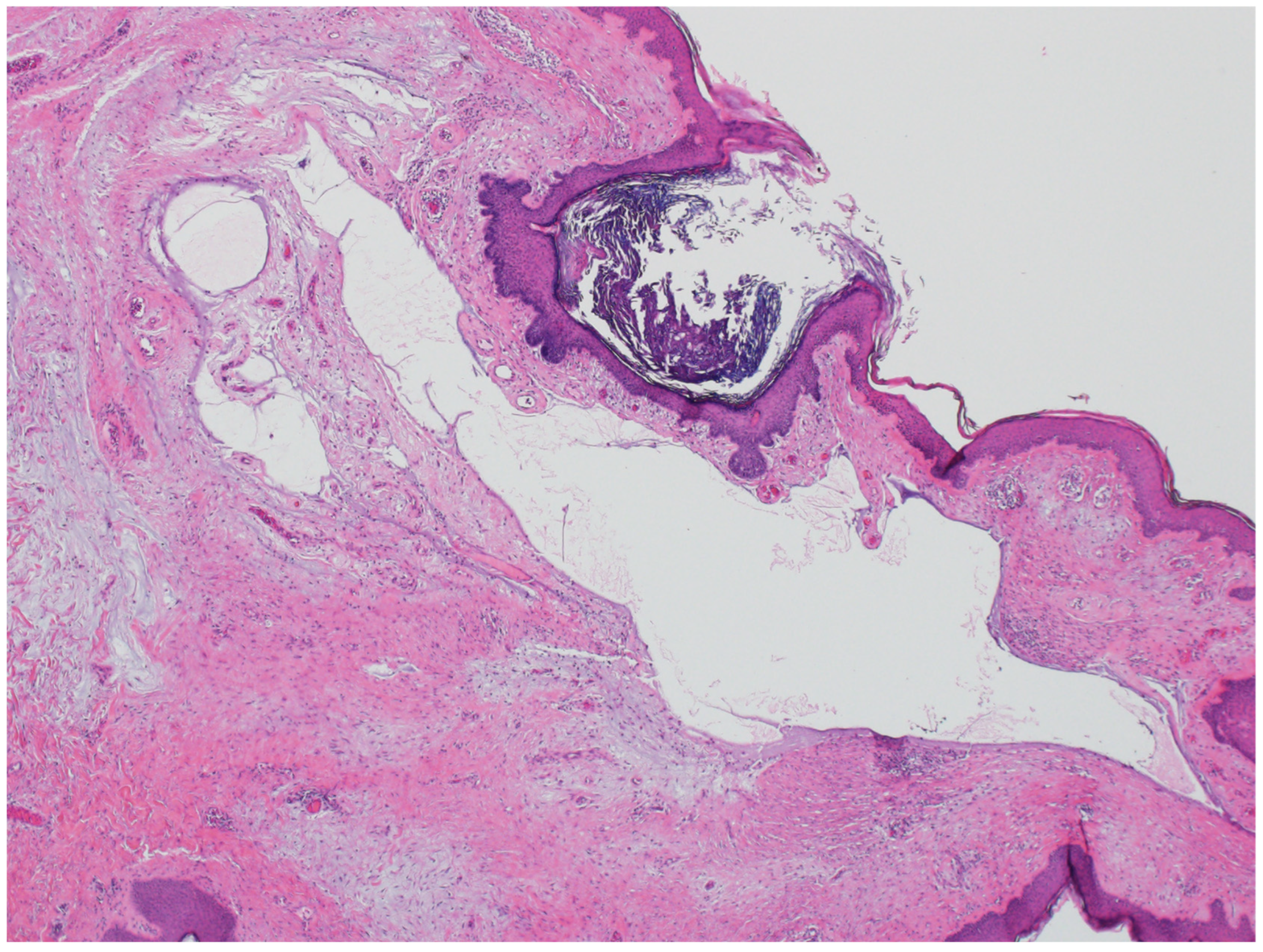 Dermatopathology 12 00034 g016 Dermatopathology 12 00034 g016
