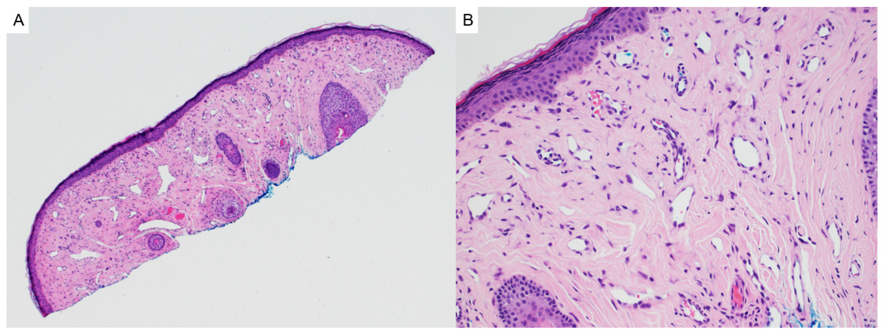 Dermatopathology 12 00034 g017 Dermatopathology 12 00034 g017