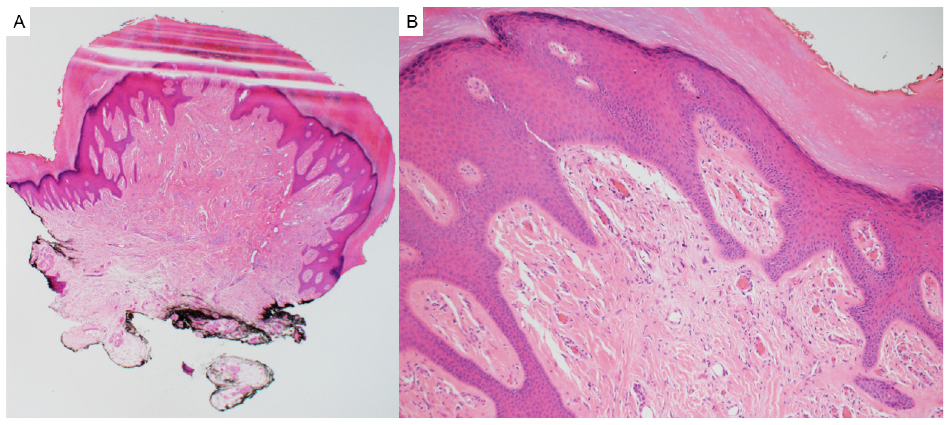 Dermatopathology 12 00034 g018 Dermatopathology 12 00034 g018