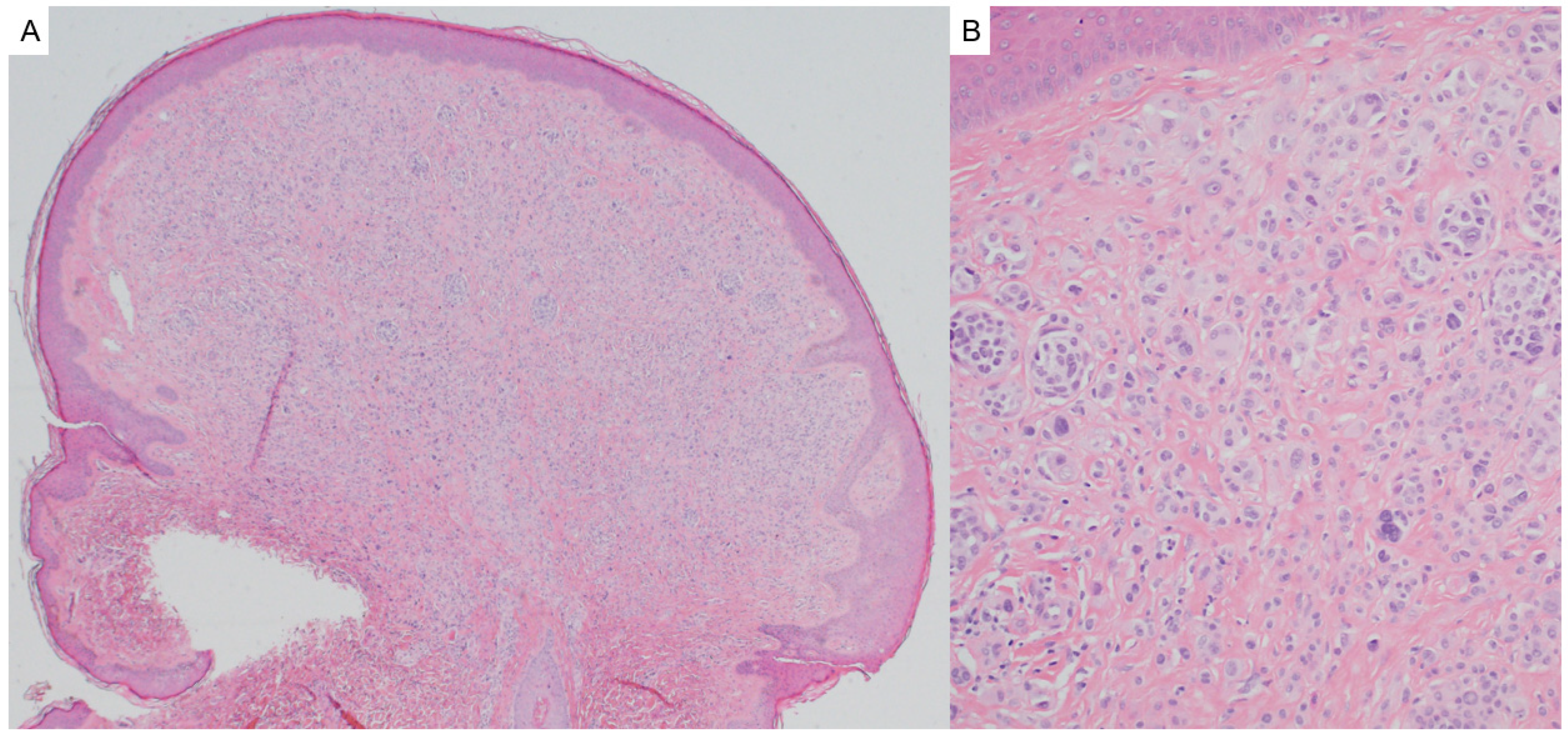 Dermatopathology 12 00034 g019 Dermatopathology 12 00034 g019