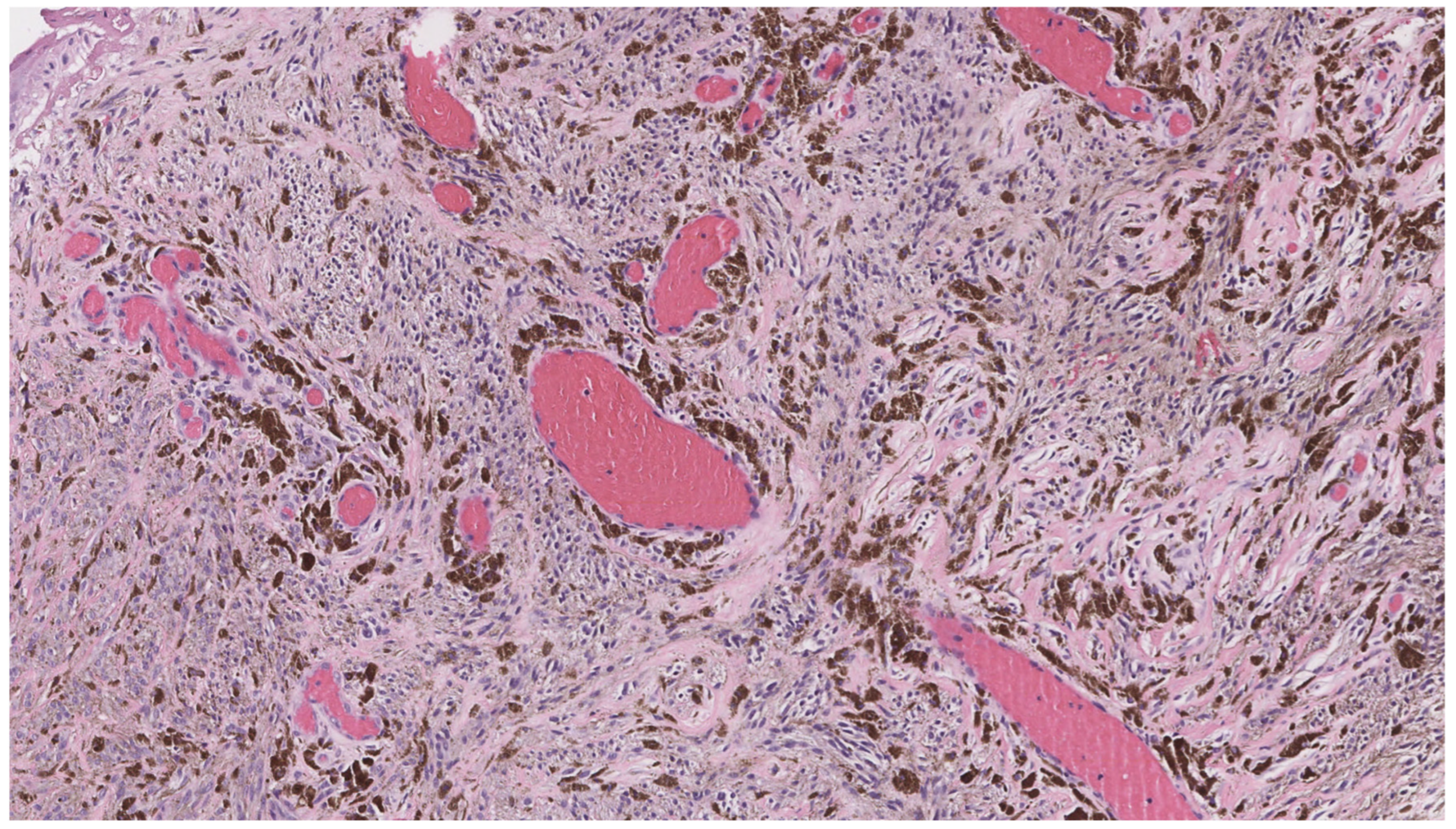 Dermatopathology 12 00034 g020 Dermatopathology 12 00034 g020