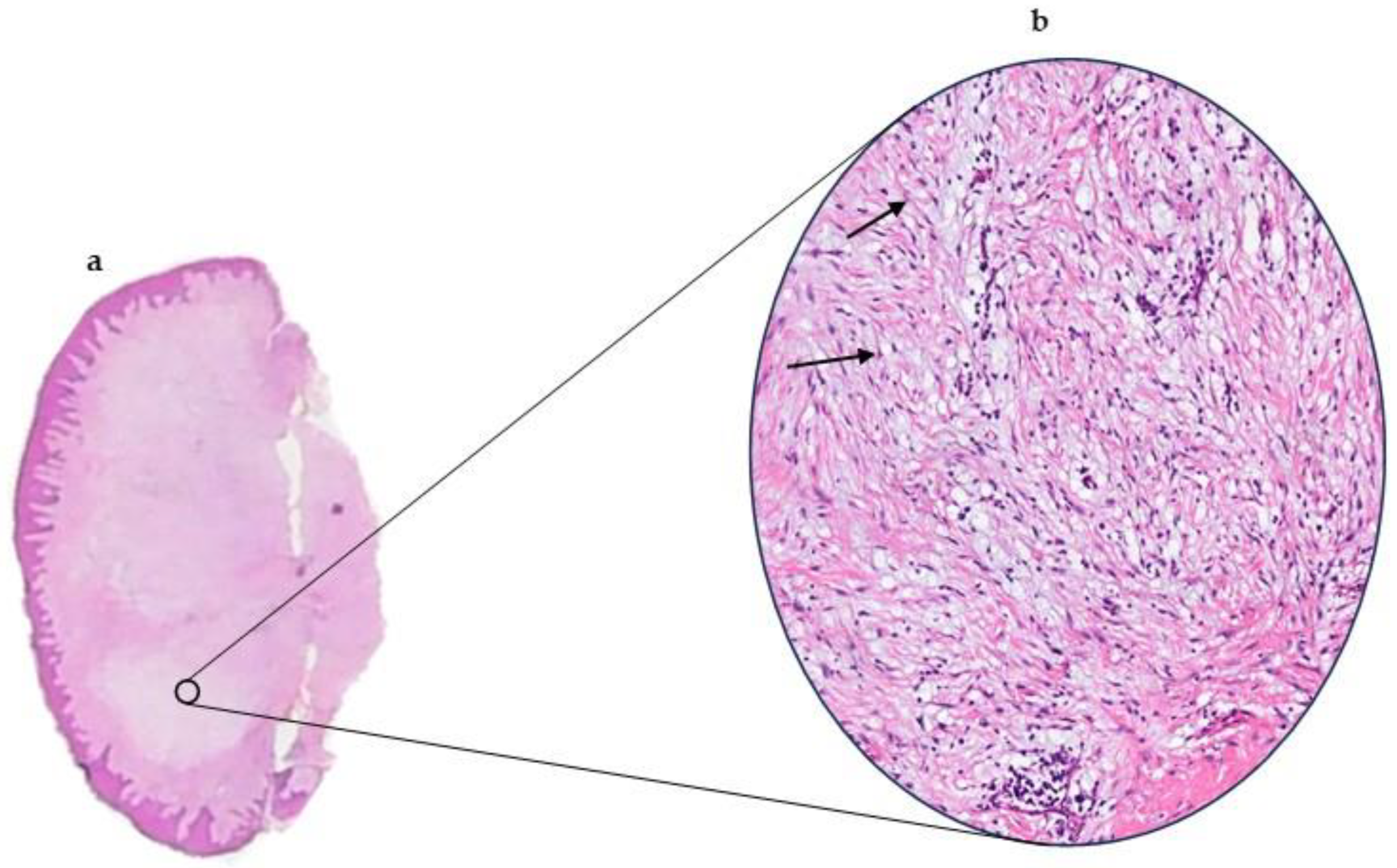 Dermatopathology 12 00038 g003 Dermatopathology 12 00038 g003