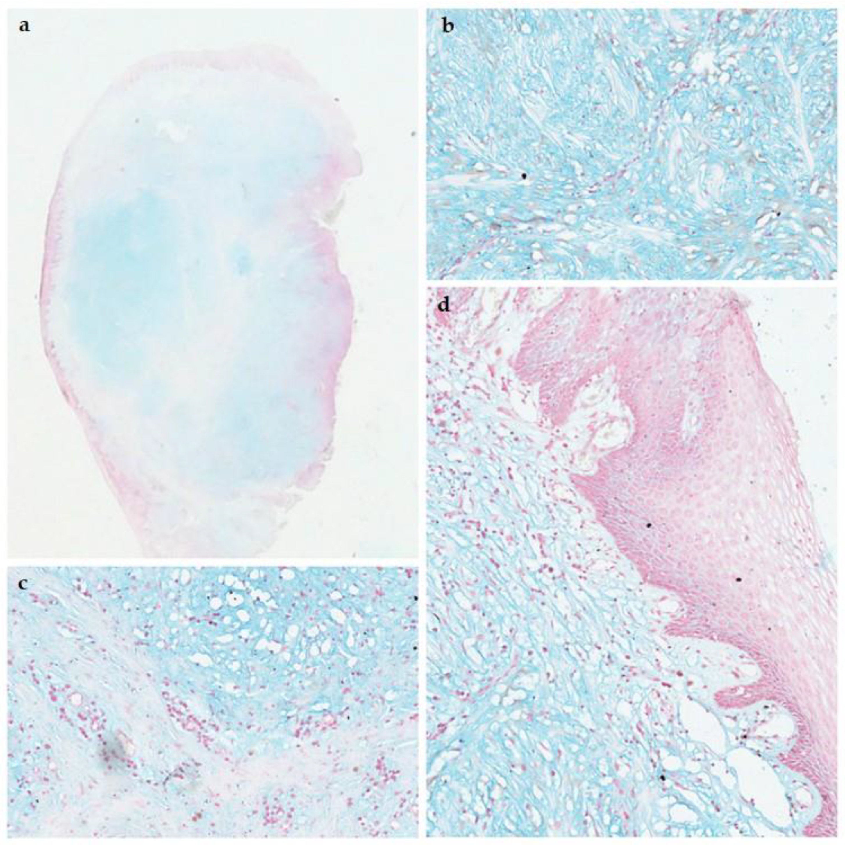 Dermatopathology 12 00038 g004 Dermatopathology 12 00038 g004