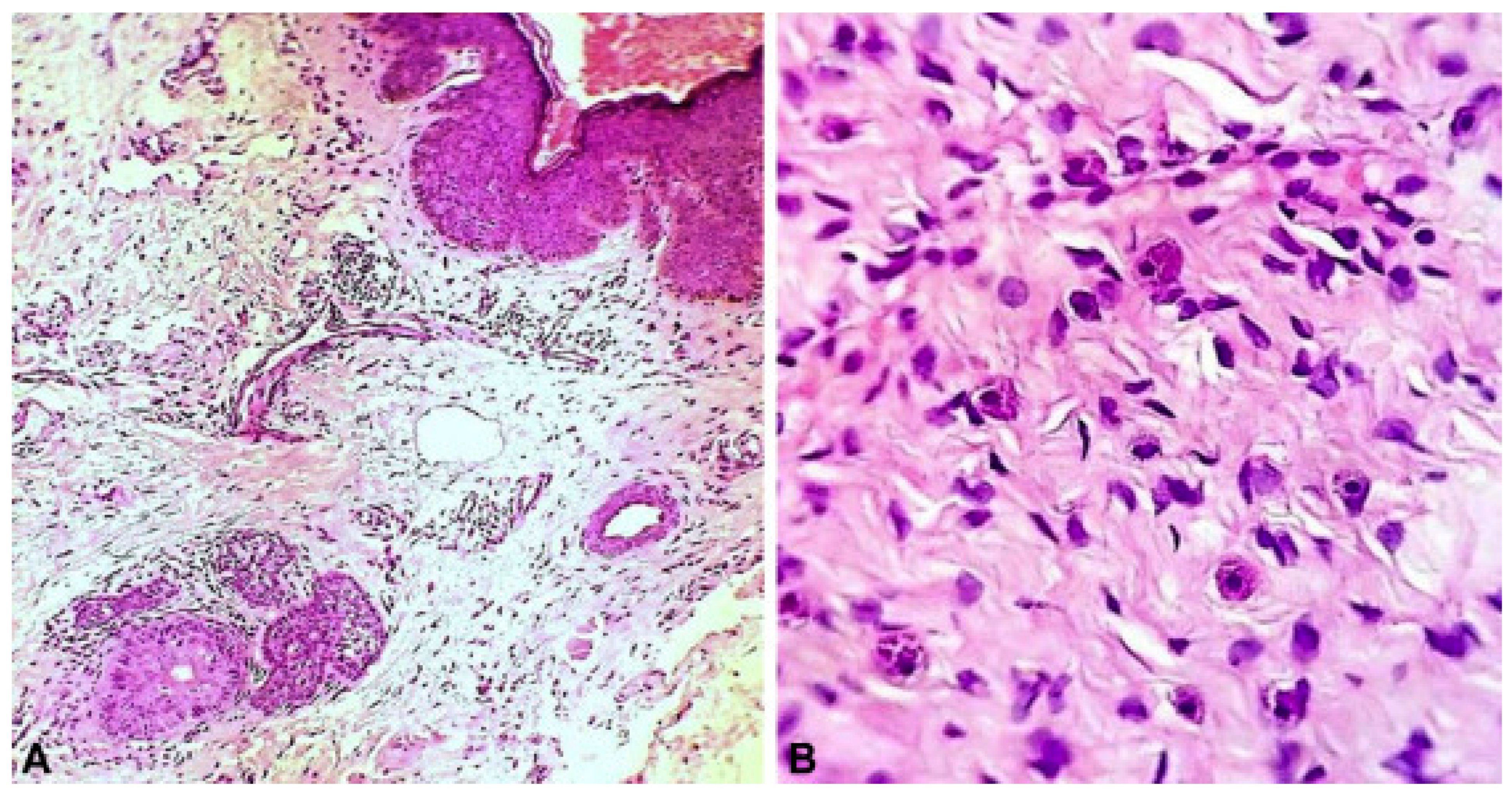 Dermatopathology 12 00039 g002 Dermatopathology 12 00039 g002