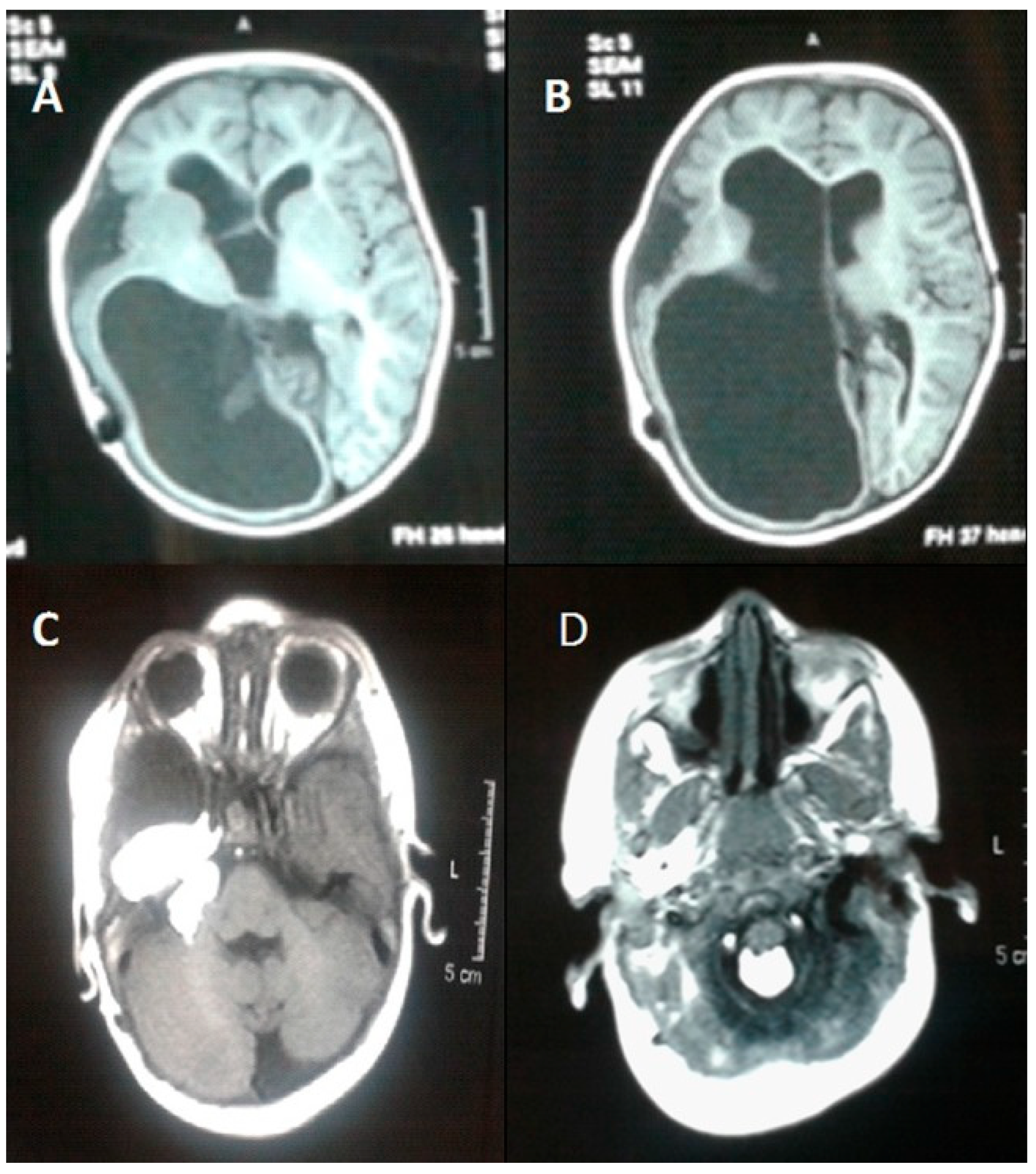 Dermatopathology 12 00039 g003 Dermatopathology 12 00039 g003