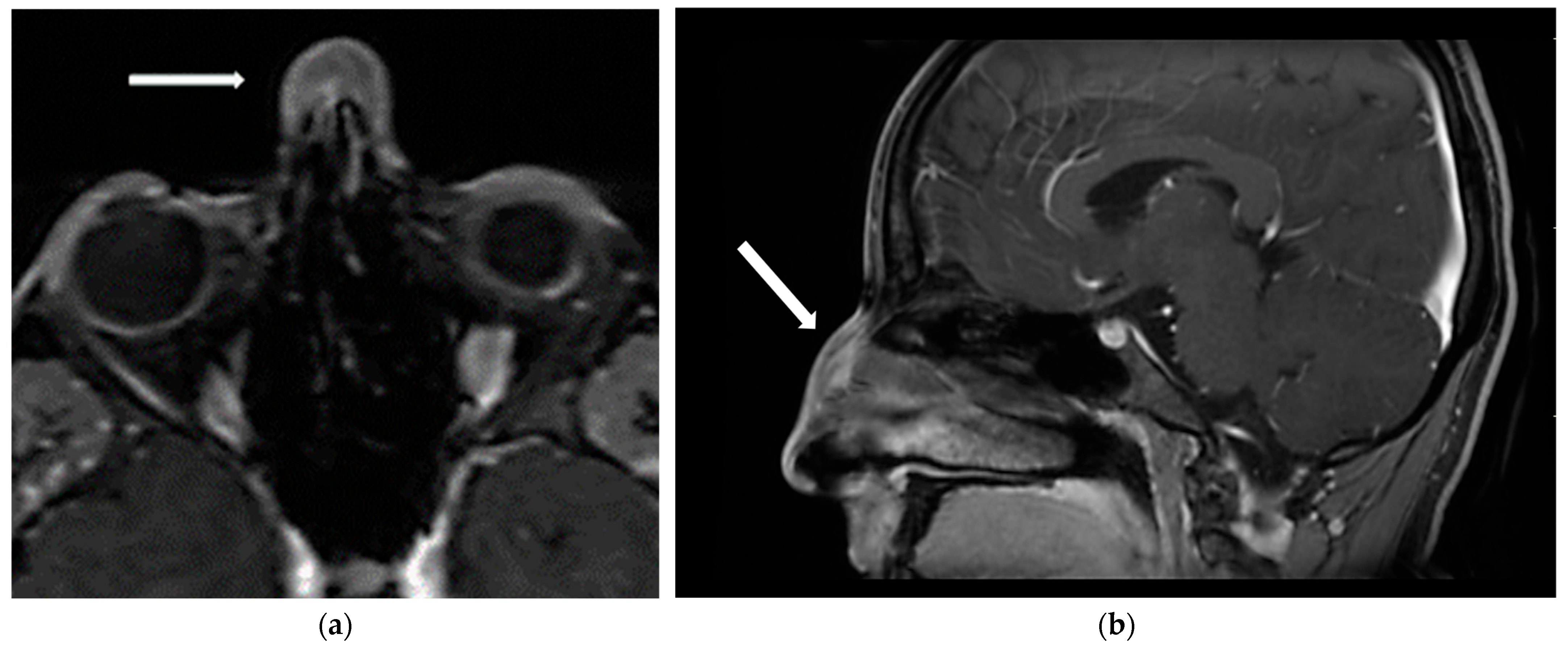 Dermatopathology 12 00040 g002
