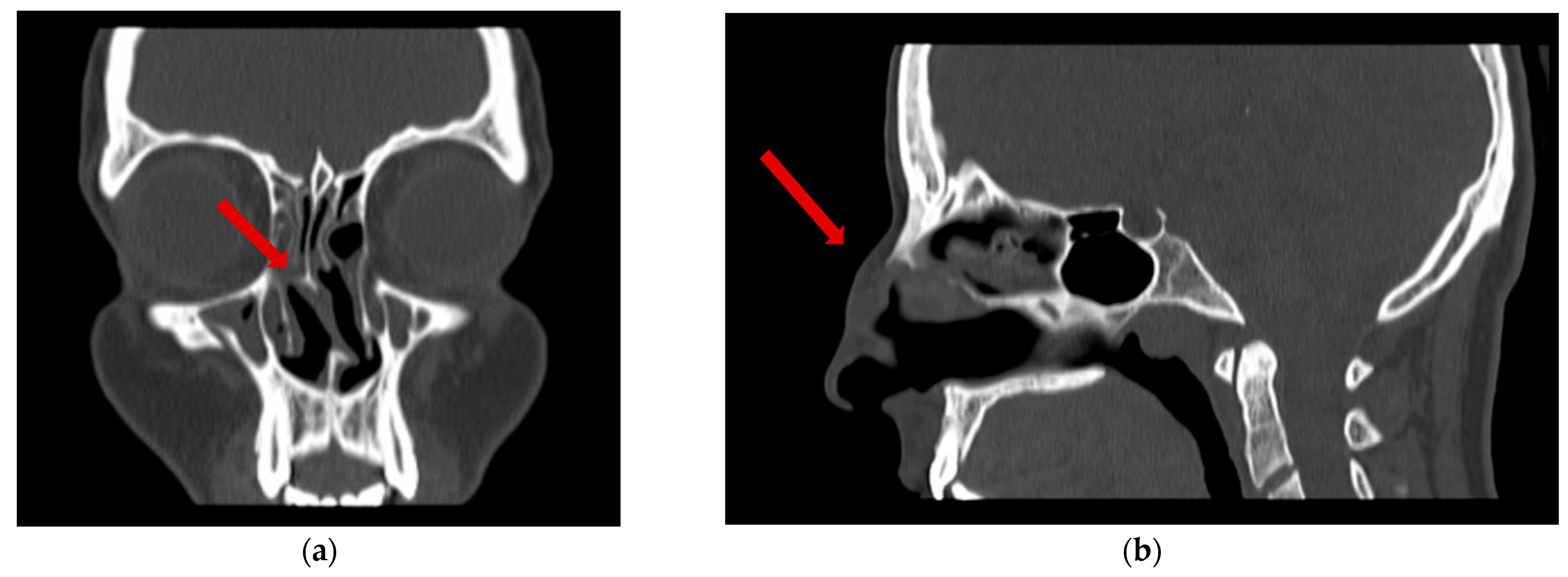 Dermatopathology 12 00040 g003