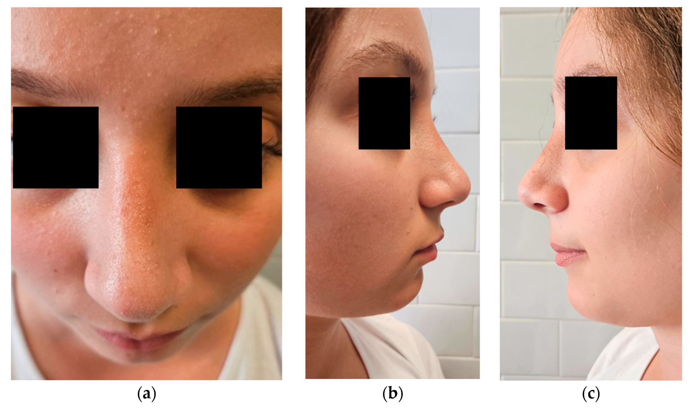 Dermatopathology 12 00040 g006