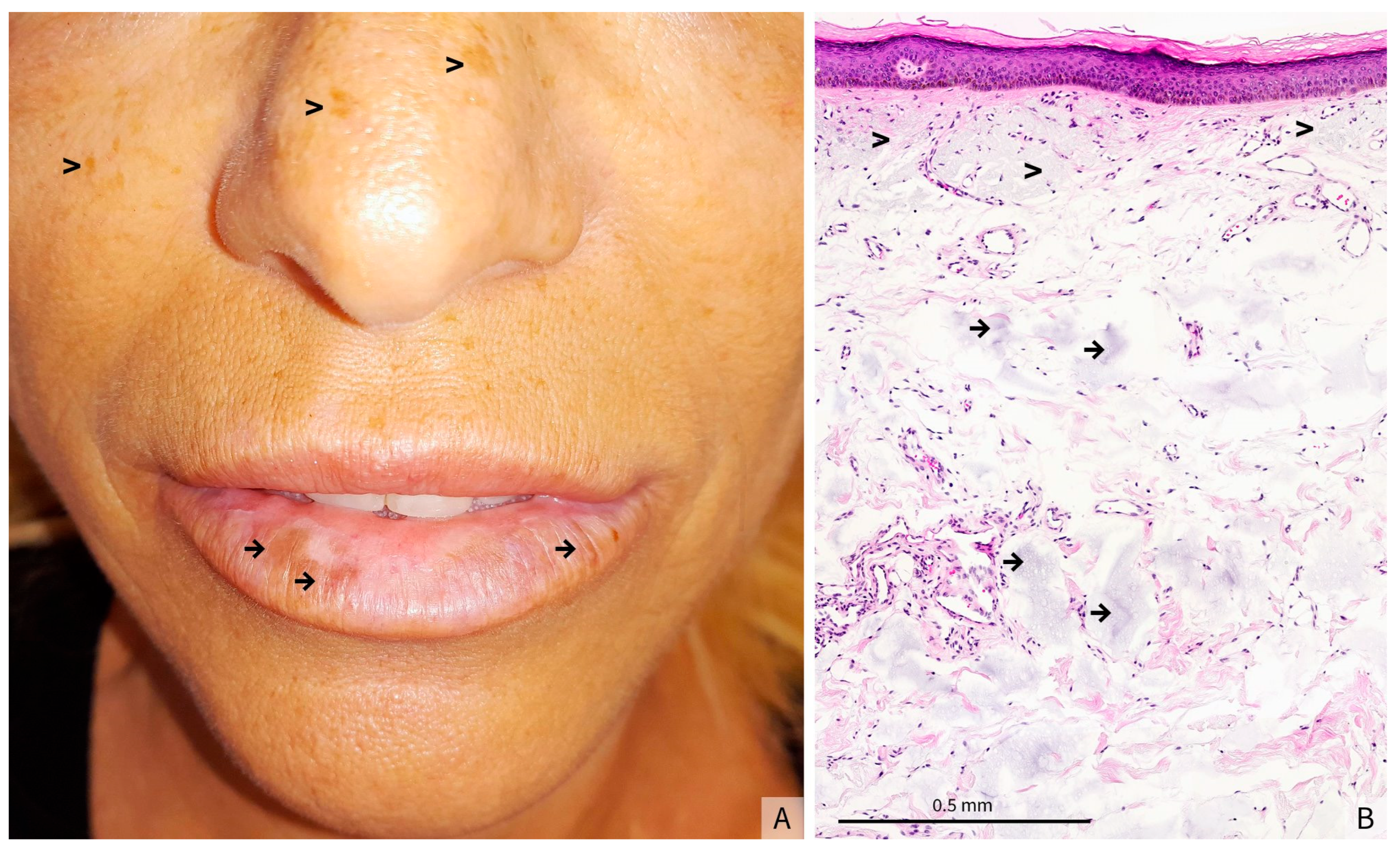 Dermatopathology 12 00041 g001