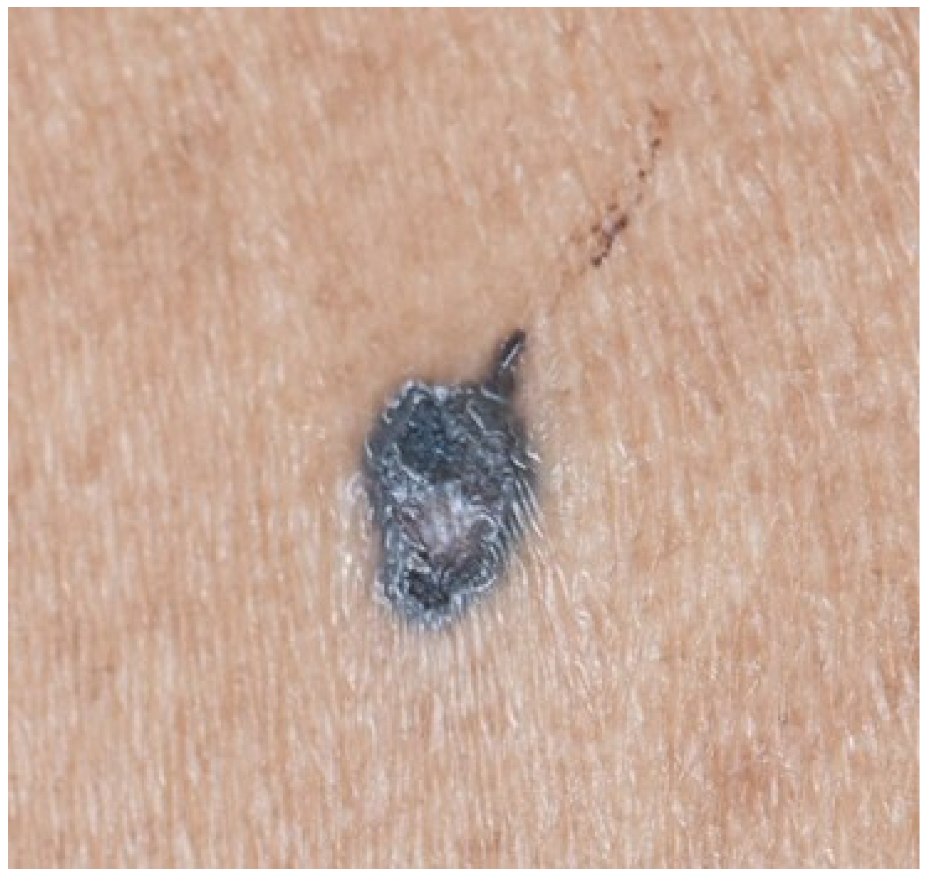 Dermatopathology 13 00004 g001 Dermatopathology 13 00004 g001