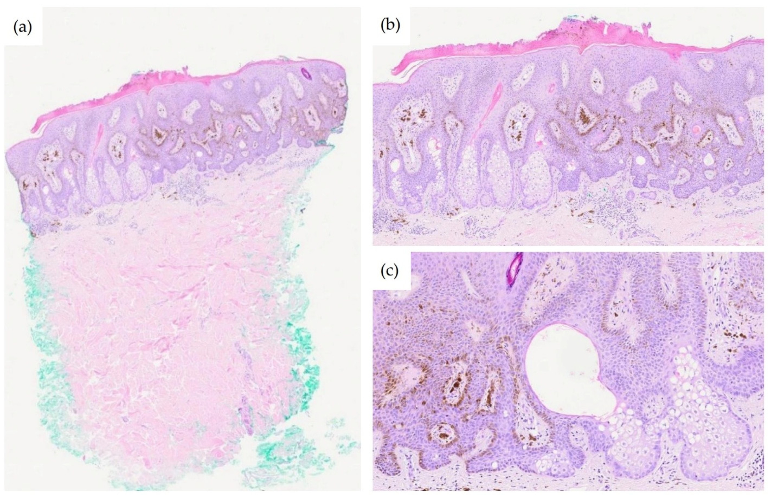 Dermatopathology 13 00004 g002 Dermatopathology 13 00004 g002
