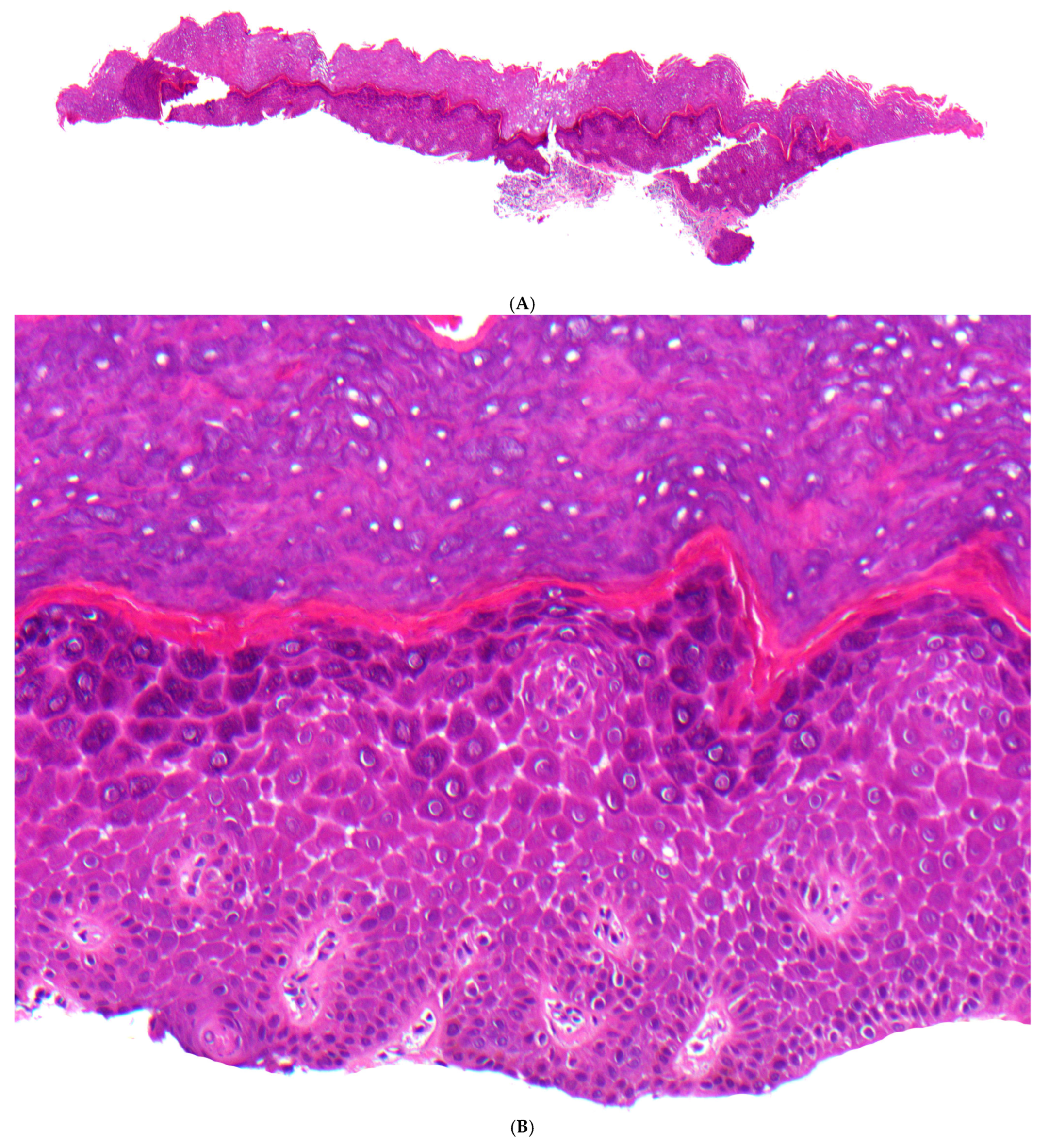 Dermatopathology 13 00017 g006a Dermatopathology 13 00017 g006a