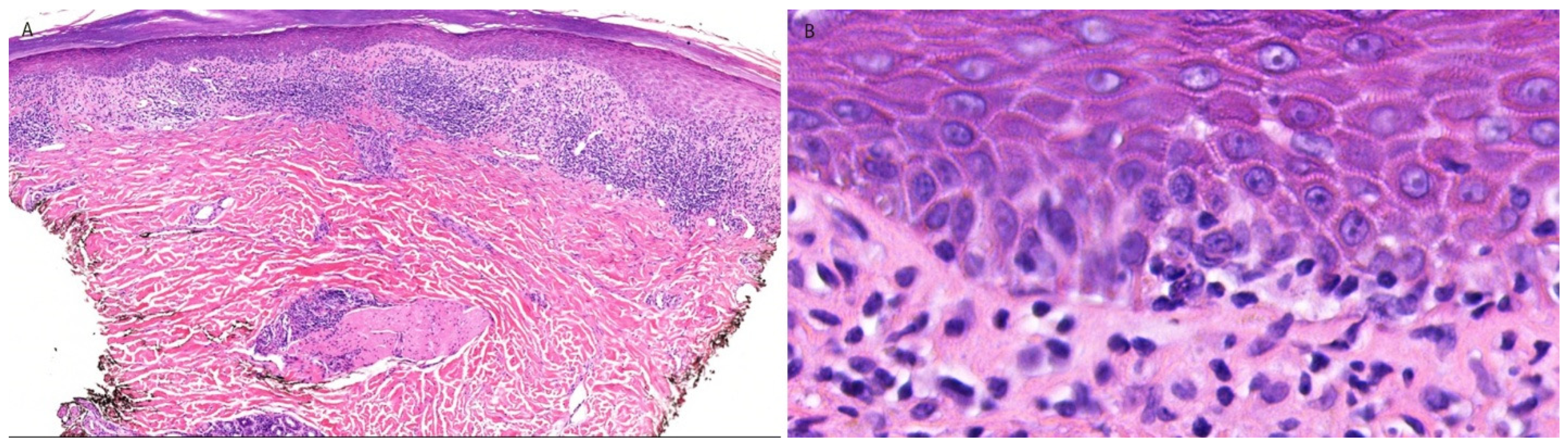Dermatopathology 13 00023 g005