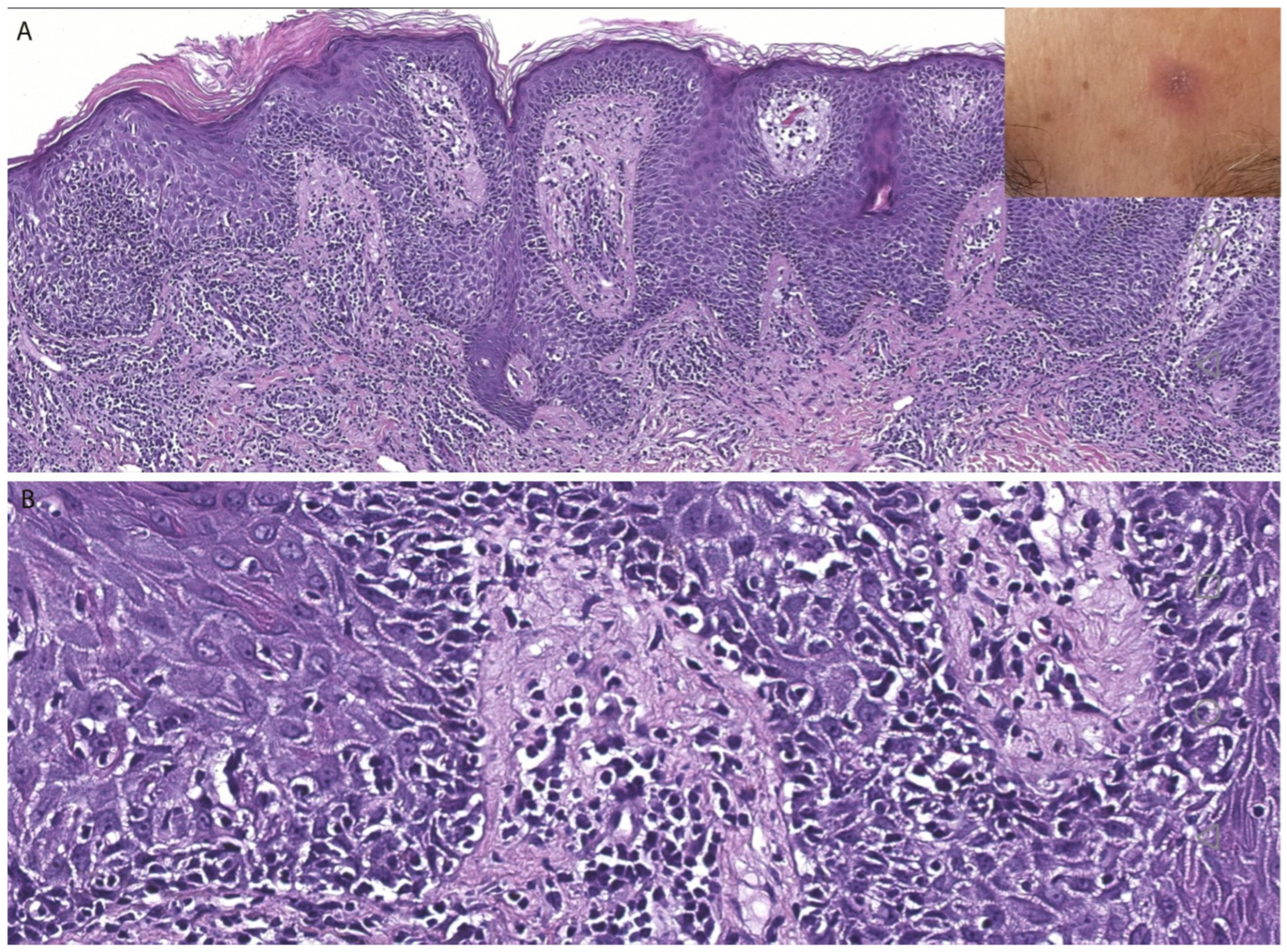Dermatopathology 13 00023 g006