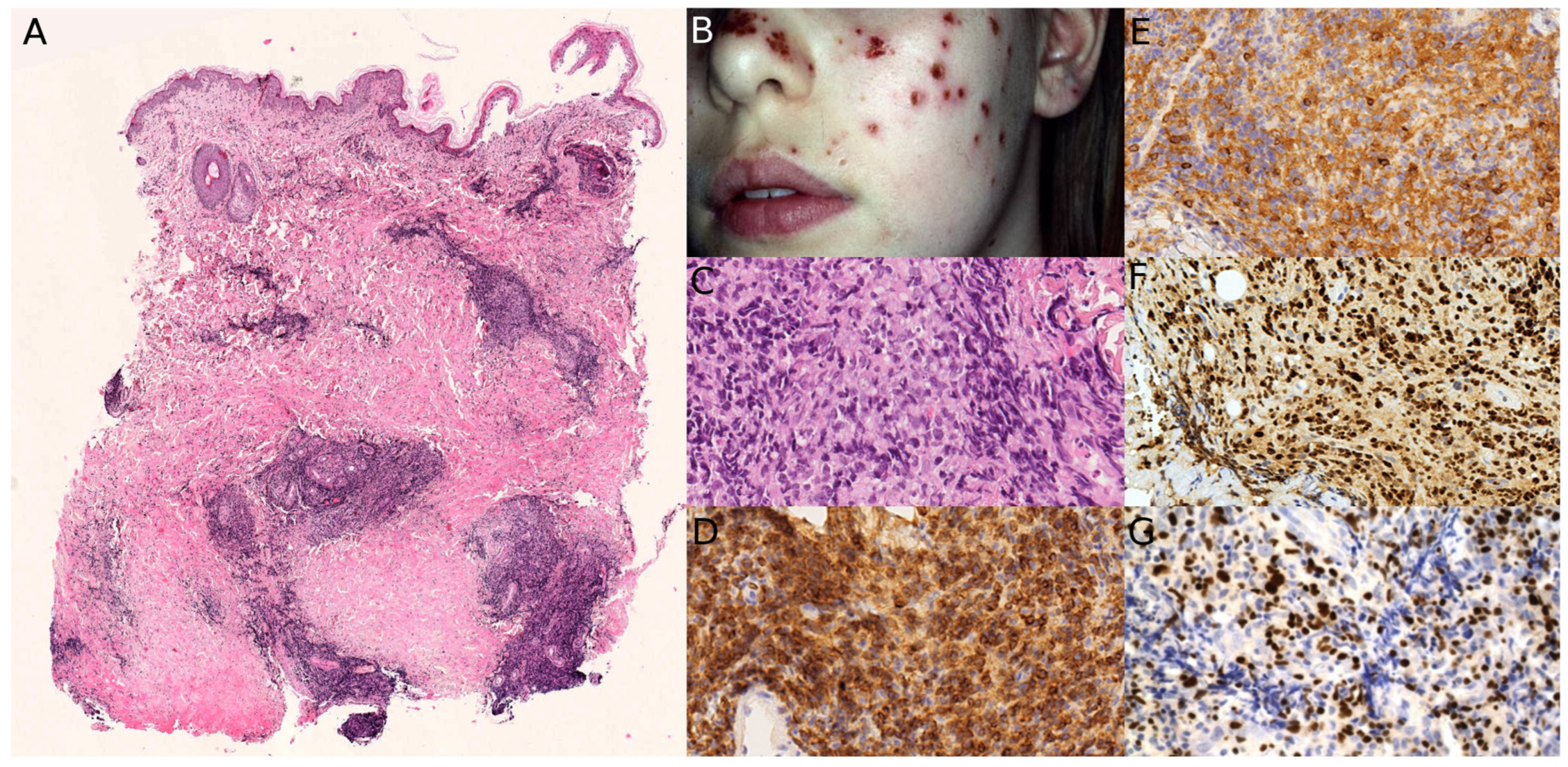 Dermatopathology 13 00024 g008 Dermatopathology 13 00024 g008