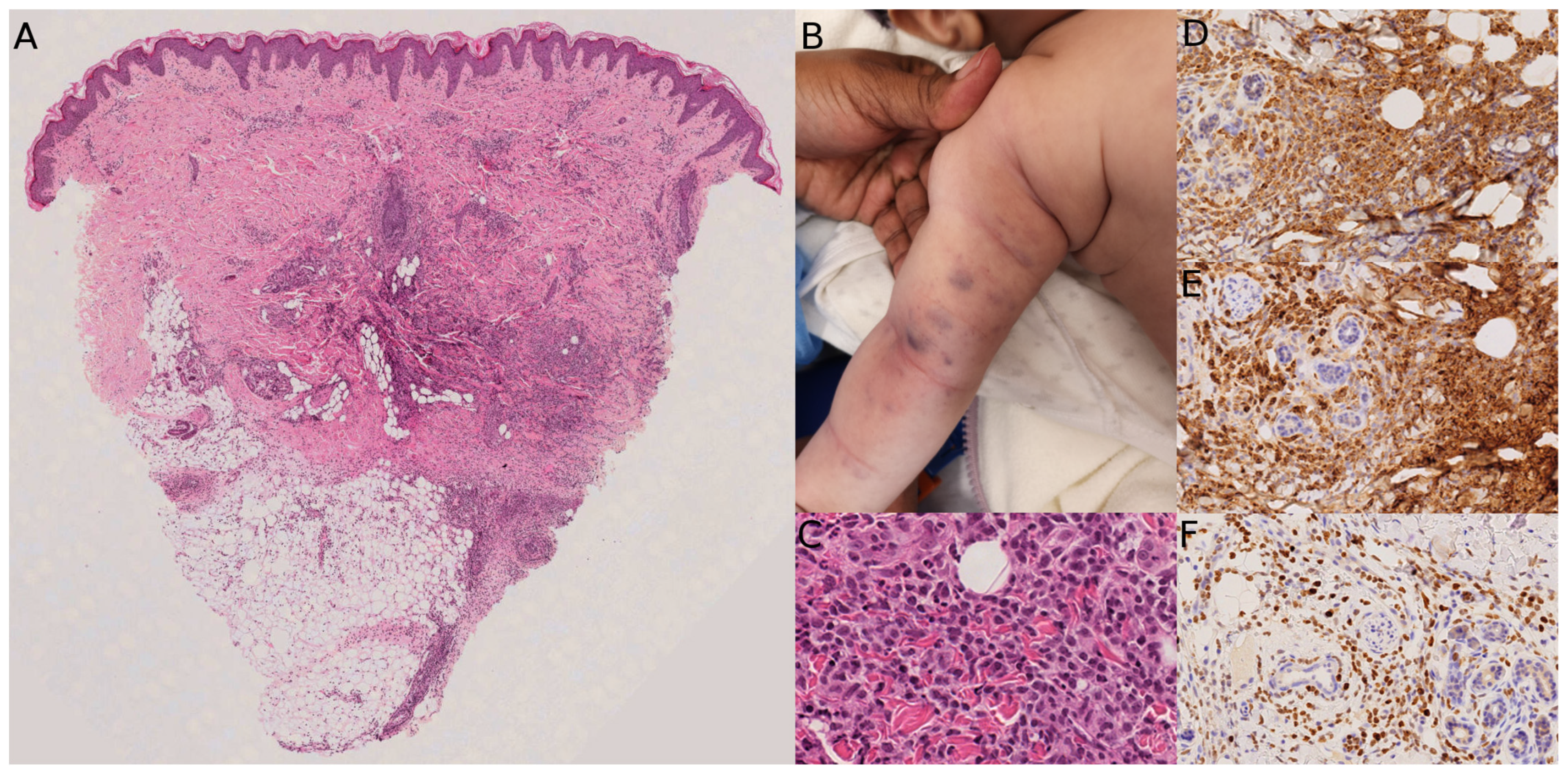 Dermatopathology 13 00024 g009 Dermatopathology 13 00024 g009