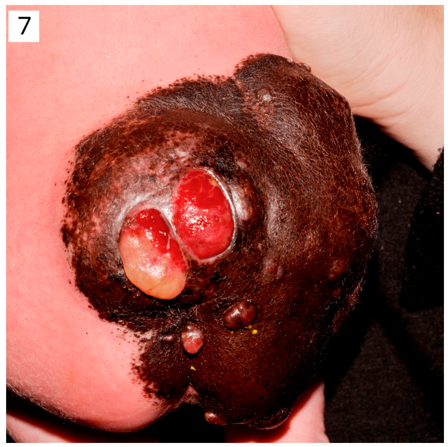 Dermatopathology 13 00028 g007 Dermatopathology 13 00028 g007