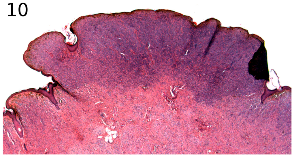 Dermatopathology 13 00028 g010 Dermatopathology 13 00028 g010