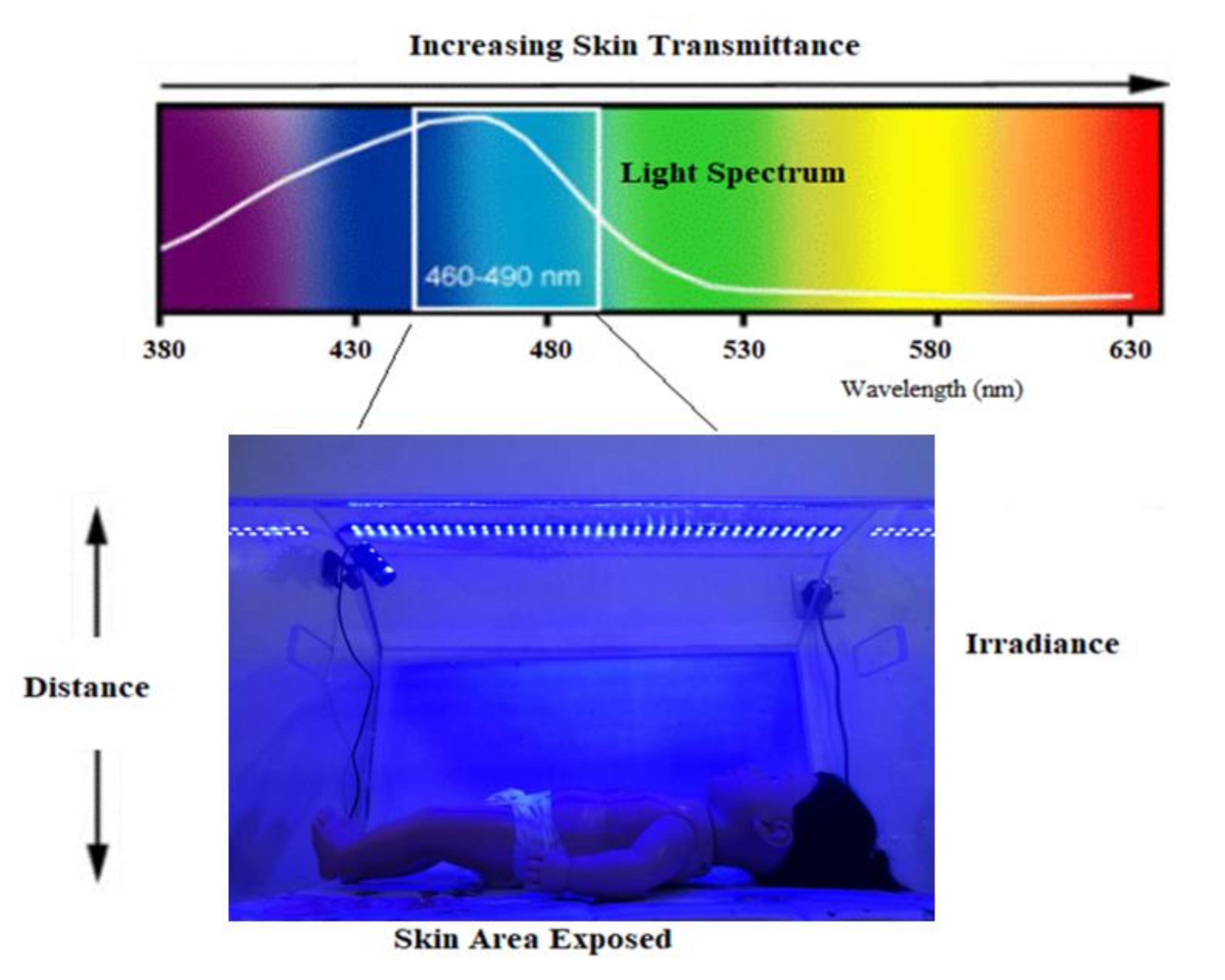 Led Lights For Jaundice at Jeffrey Caouette blog