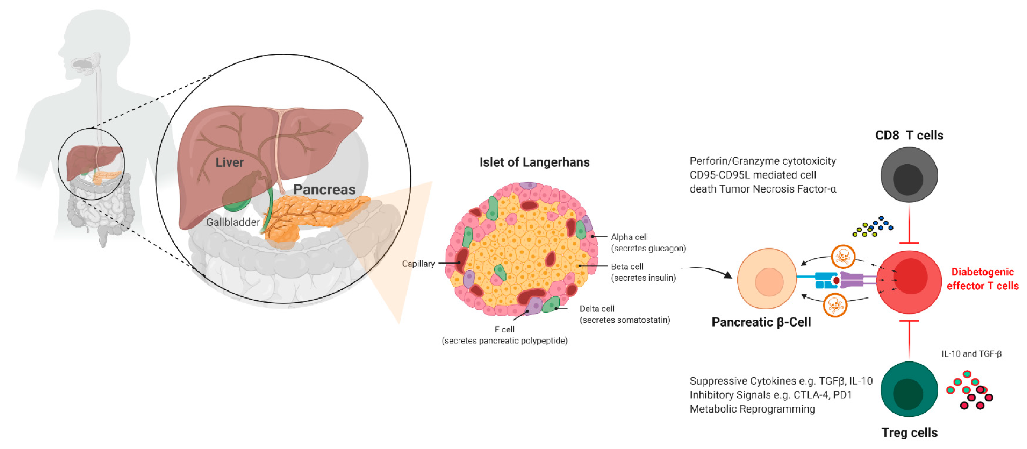Diabetology 03 00007 g003 Diabetology 03 00007 g003