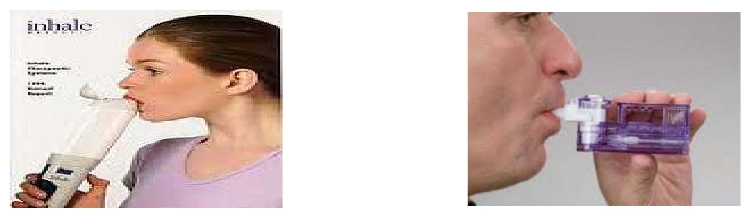 Diabetology 03 00010 g057