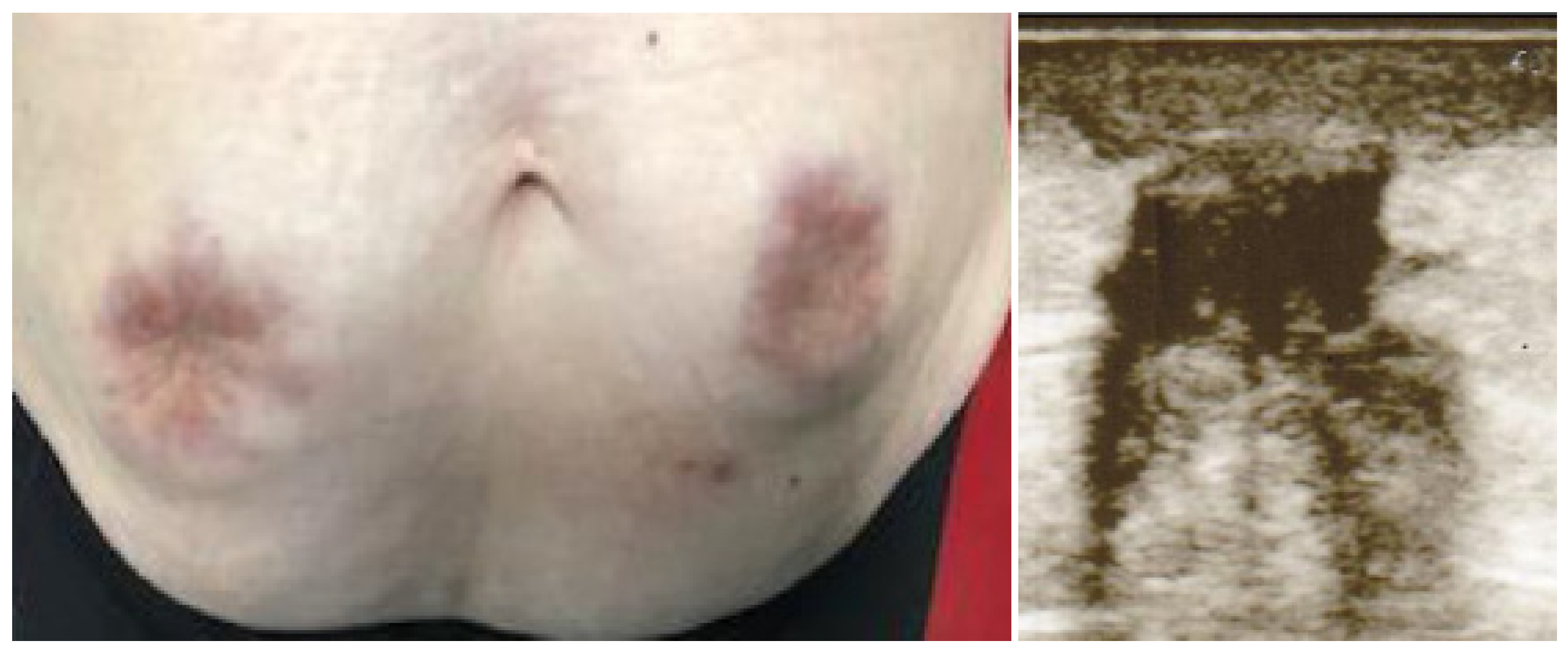 Diabetology 03 00047 g001 Diabetology 03 00047 g001