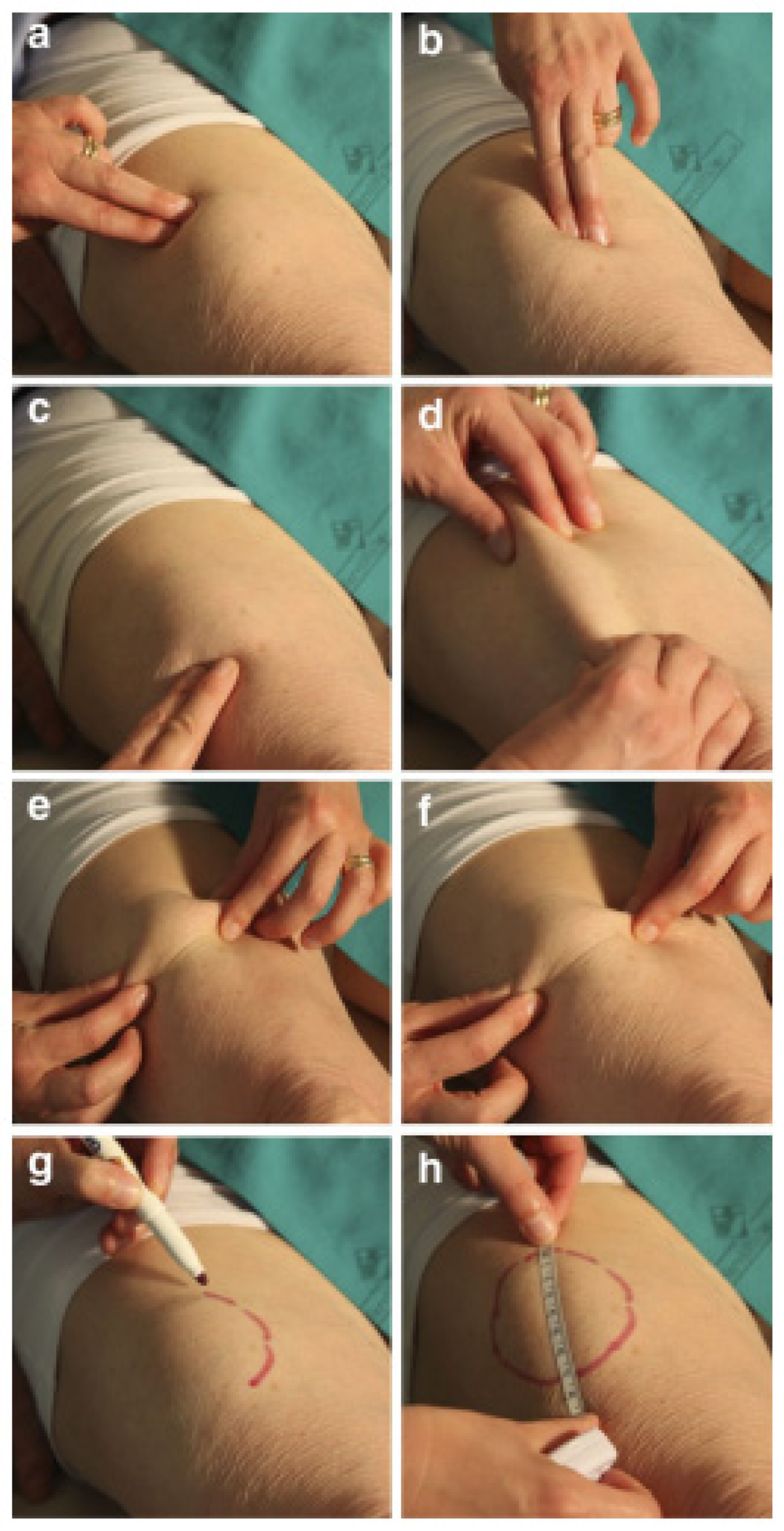 Diabetology 03 00047 g002 Diabetology 03 00047 g002