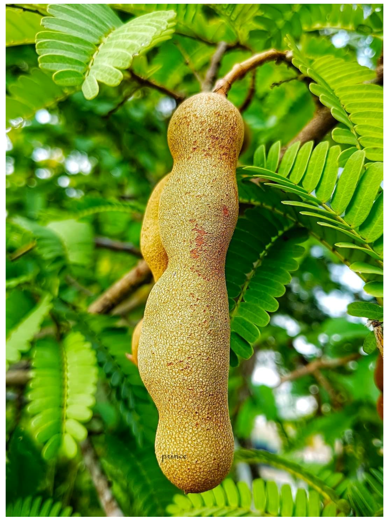 Diabetology 04 00019 g034 Diabetology 04 00019 g034