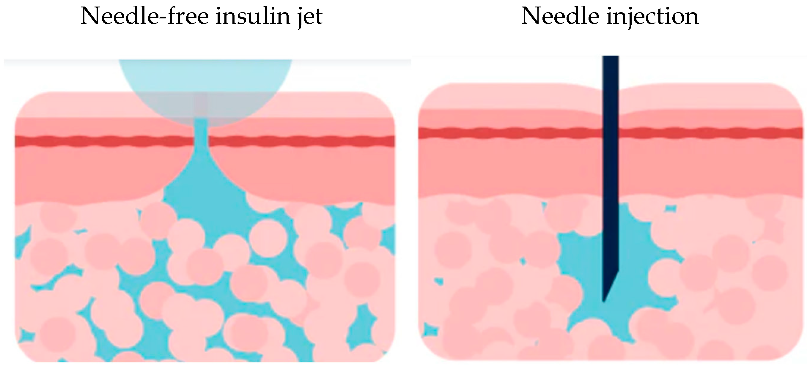 Diabetology 06 00022 g003