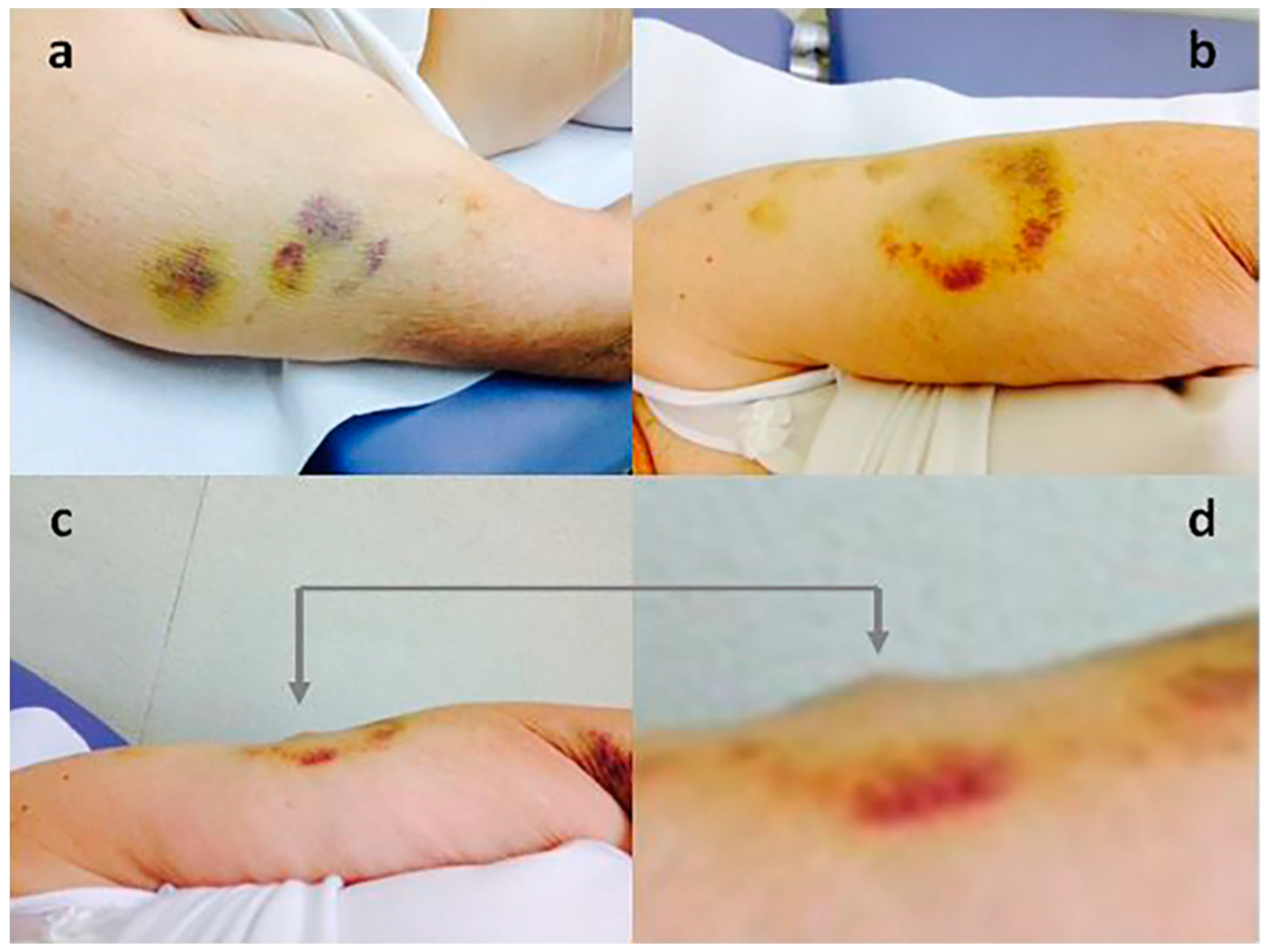 Diabetology 06 00022 g007