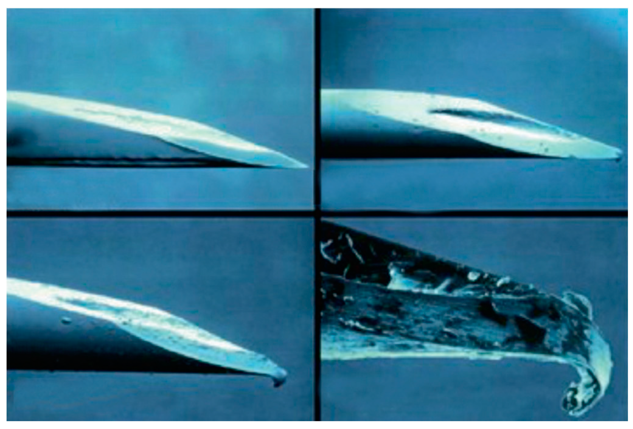 Diabetology 06 00022 g011