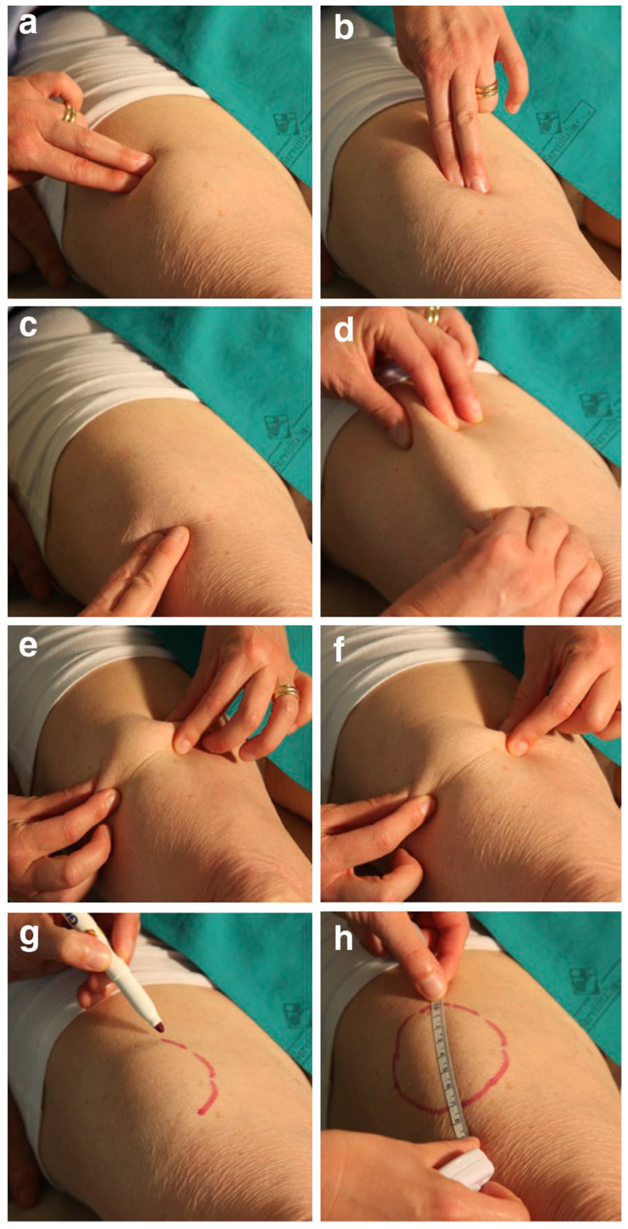 Diabetology 06 00022 g013