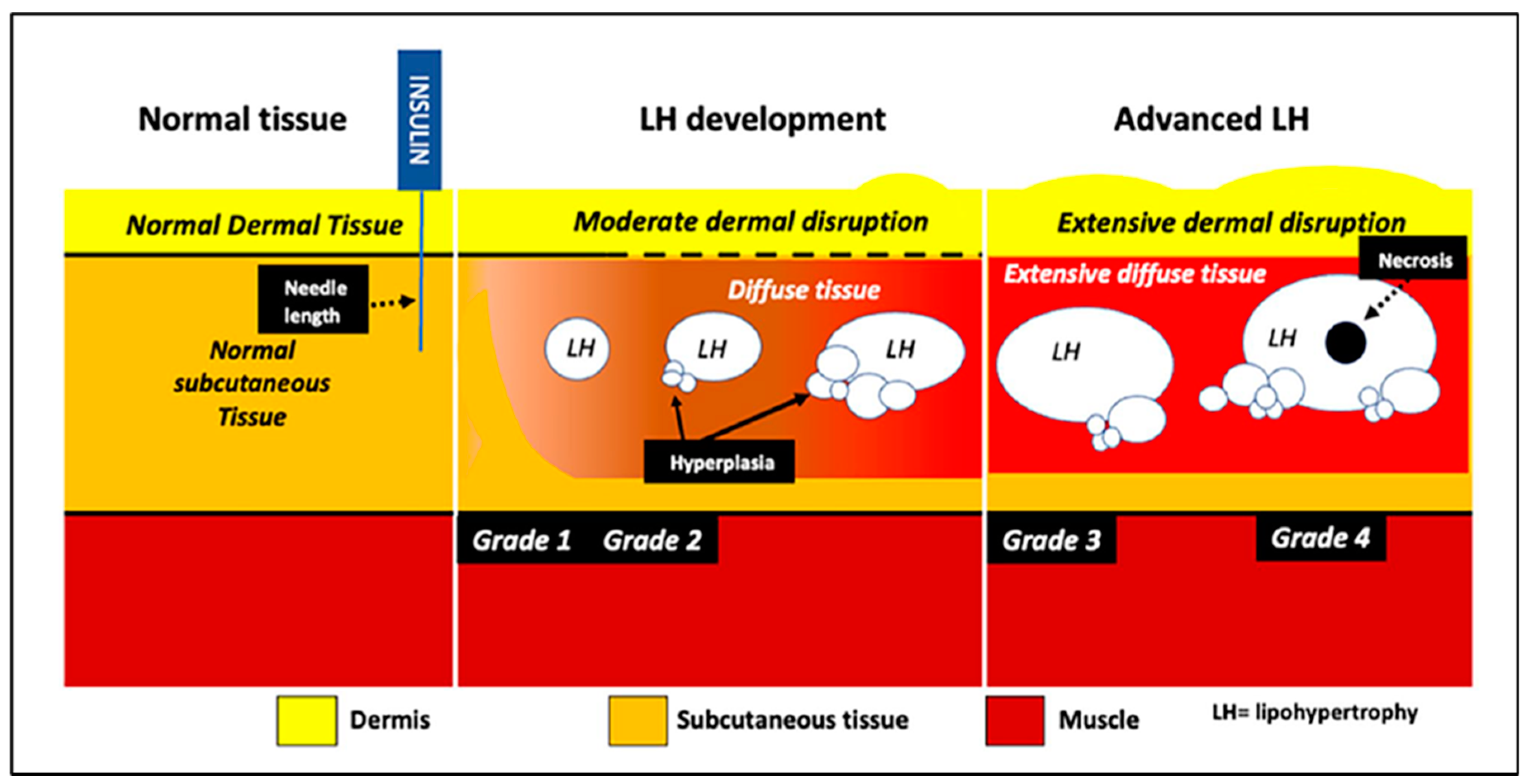 Diabetology 06 00022 g015