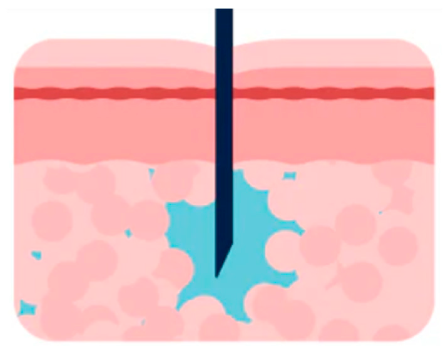 Diabetology 06 00022 g016