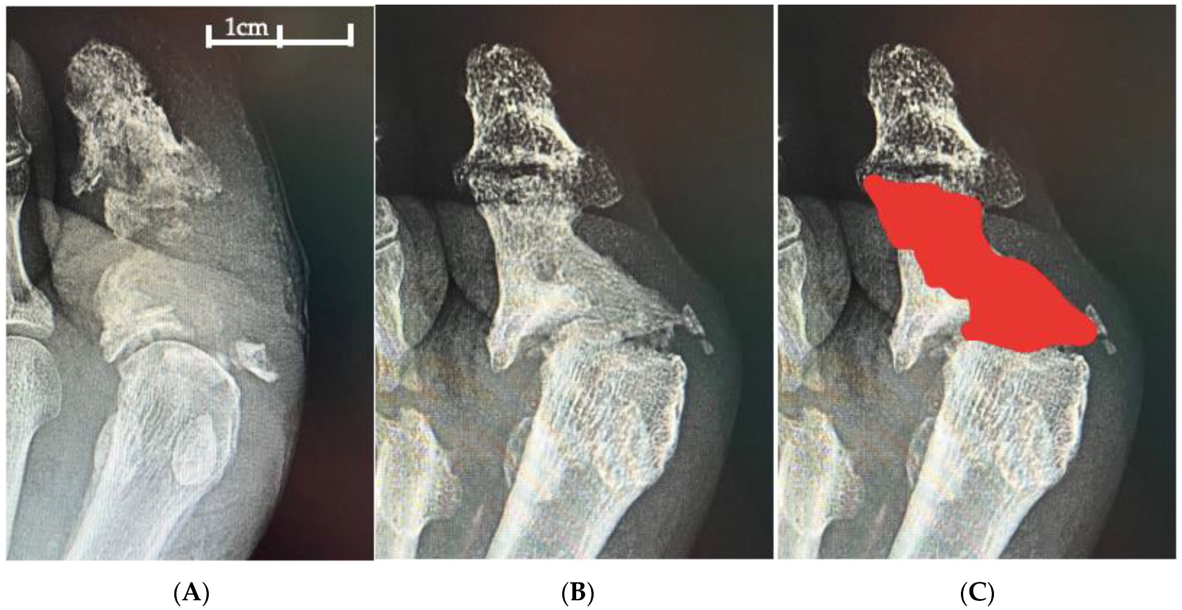 Diabetology 06 00030 g002