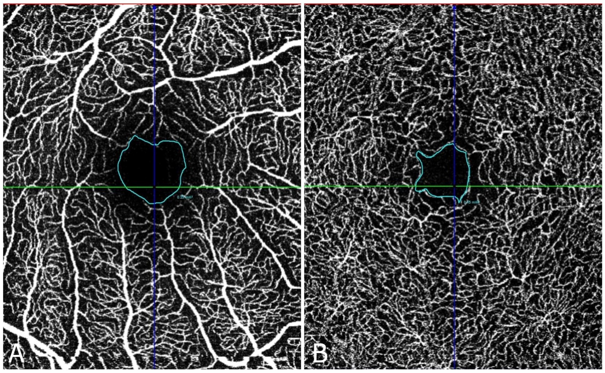 Diabetology 06 00063 g002