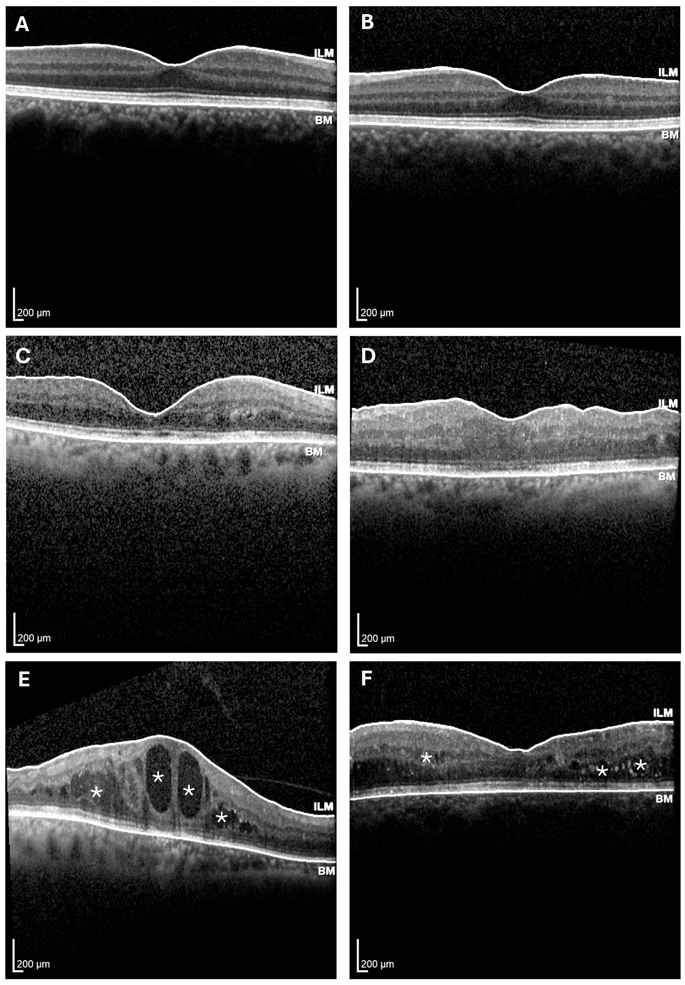 Diabetology 06 00132 g001