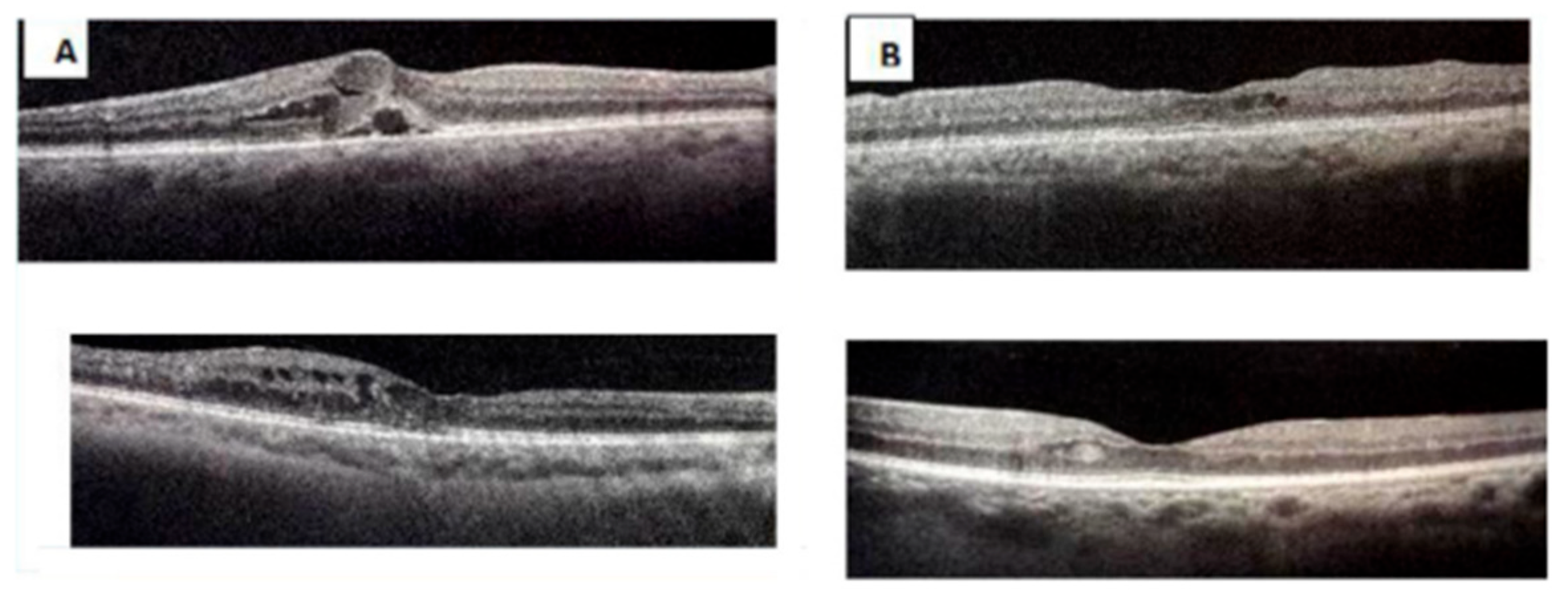 Diabetology 06 00133 g008