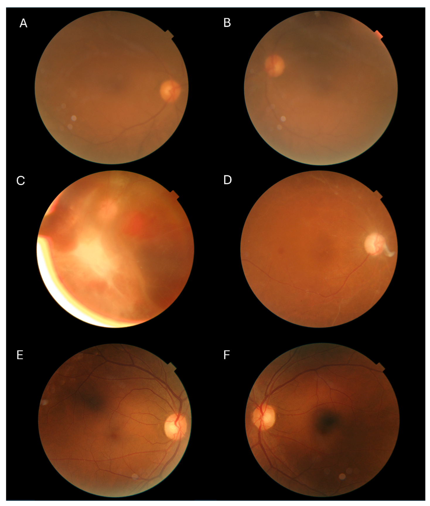 Diabetology 06 00146 g001 Diabetology 06 00146 g001