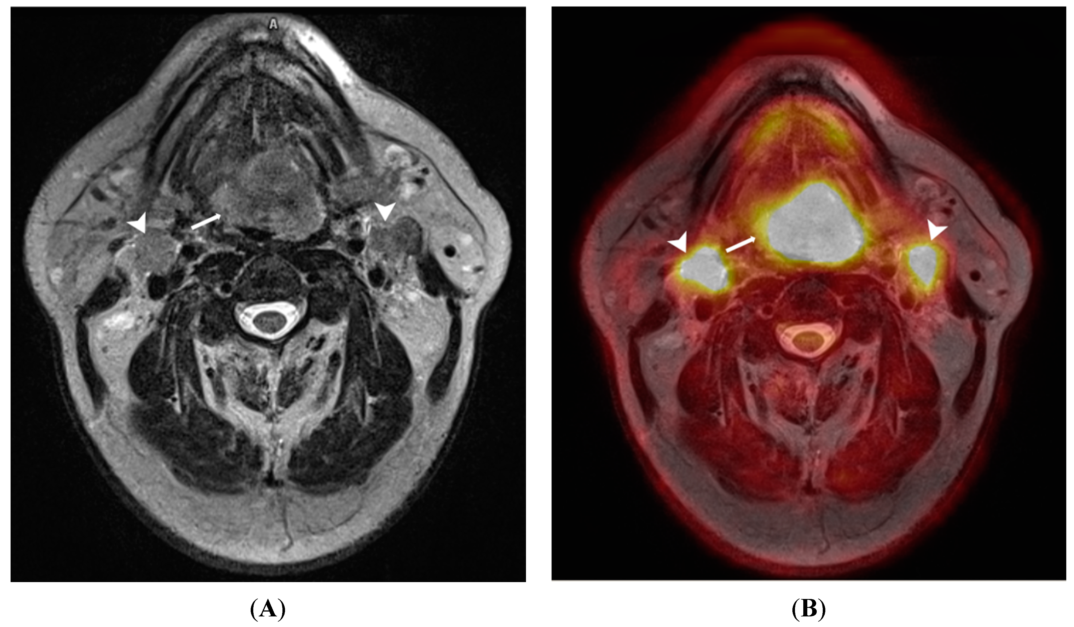 Diagnostics | Free Full-Text | PET/MRI in Oncological Imaging: State of the Art Diagnostics | Free Full-Text | PET/MRI in Oncological Imaging: State of the Art