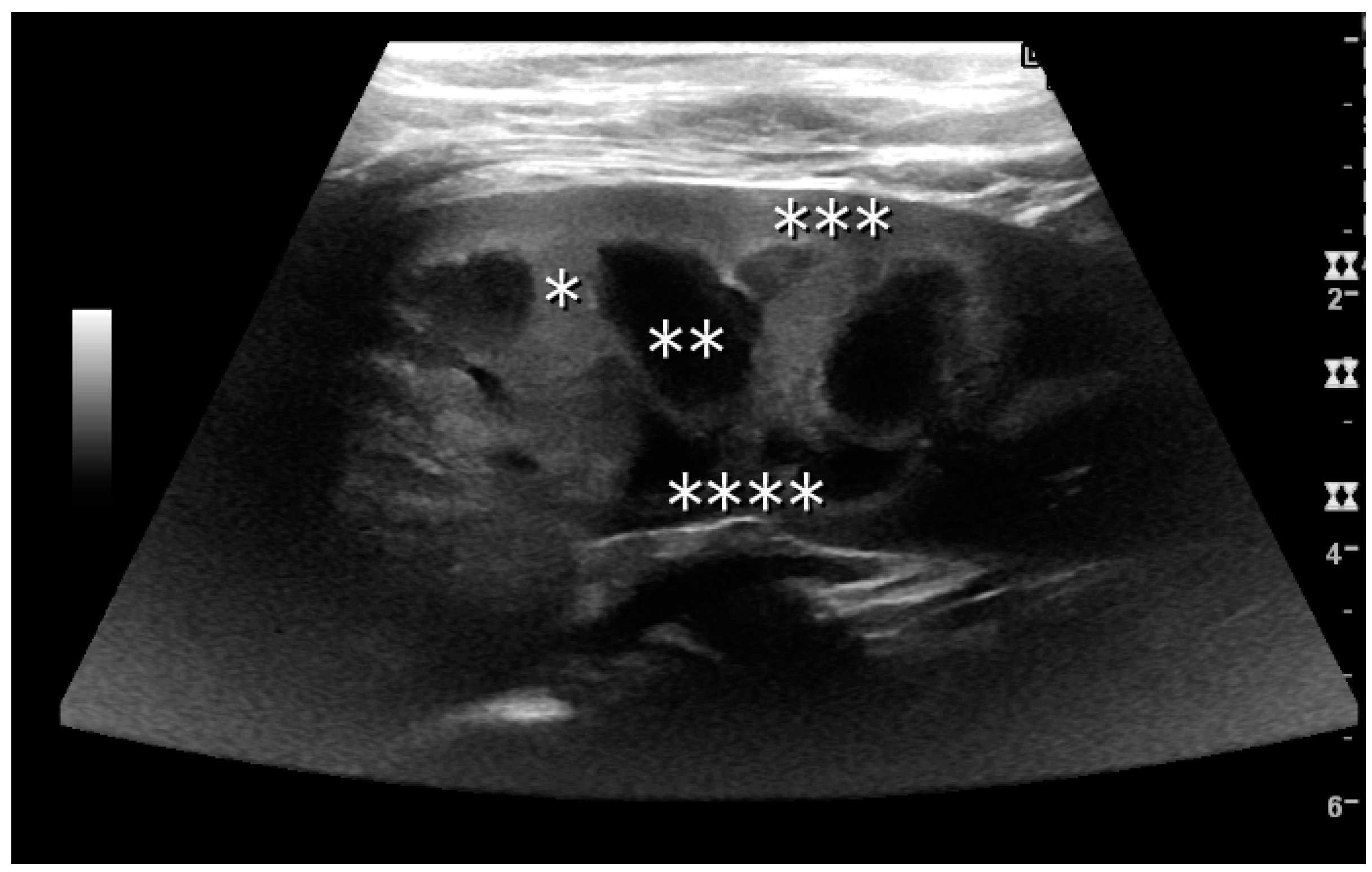 diagnostics-free-full-text-ultrasonography-of-the-kidney-a